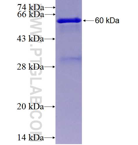 NAT1 fusion protein Ag5885 SDS-PAGE