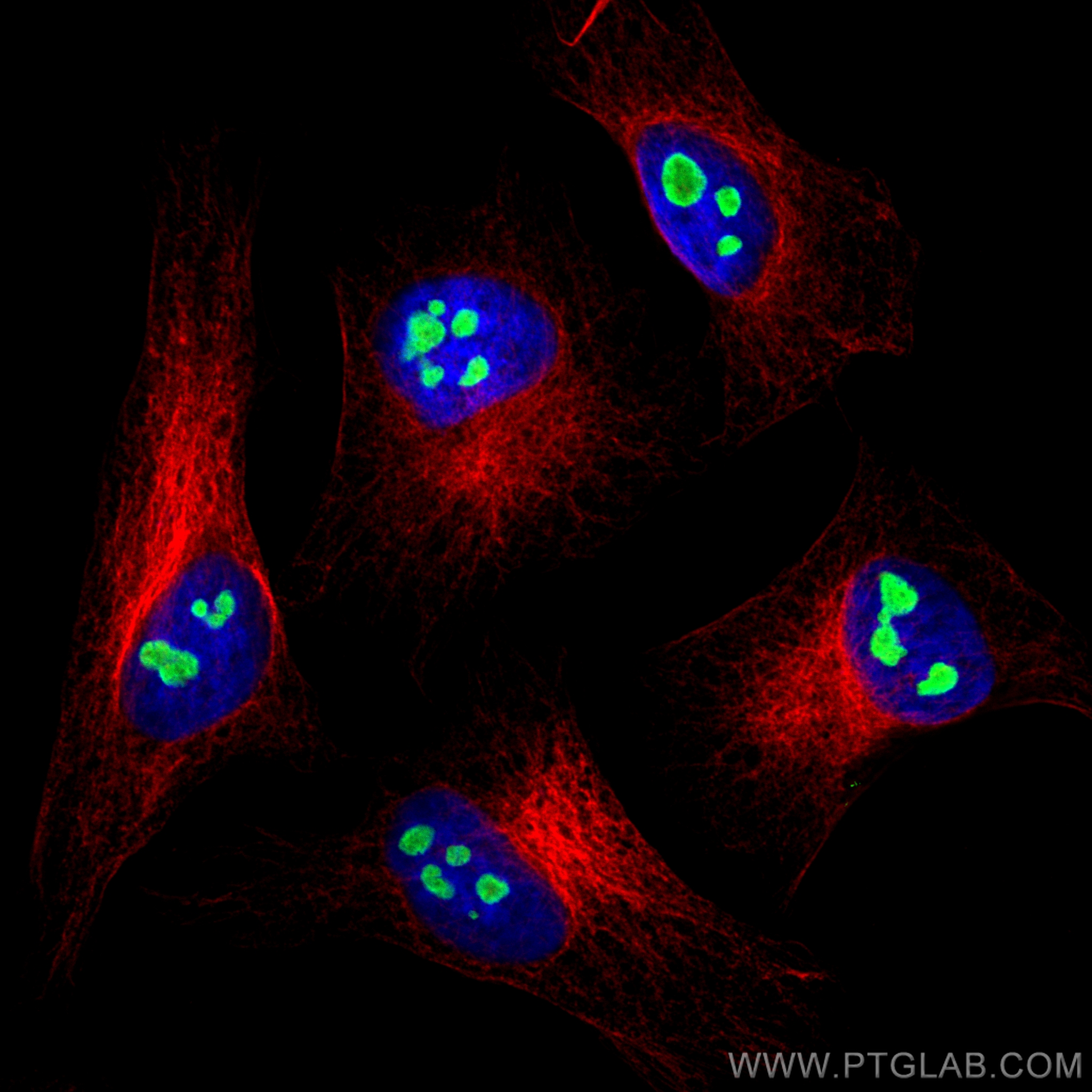 IF Staining of HeLa using 13365-1-AP