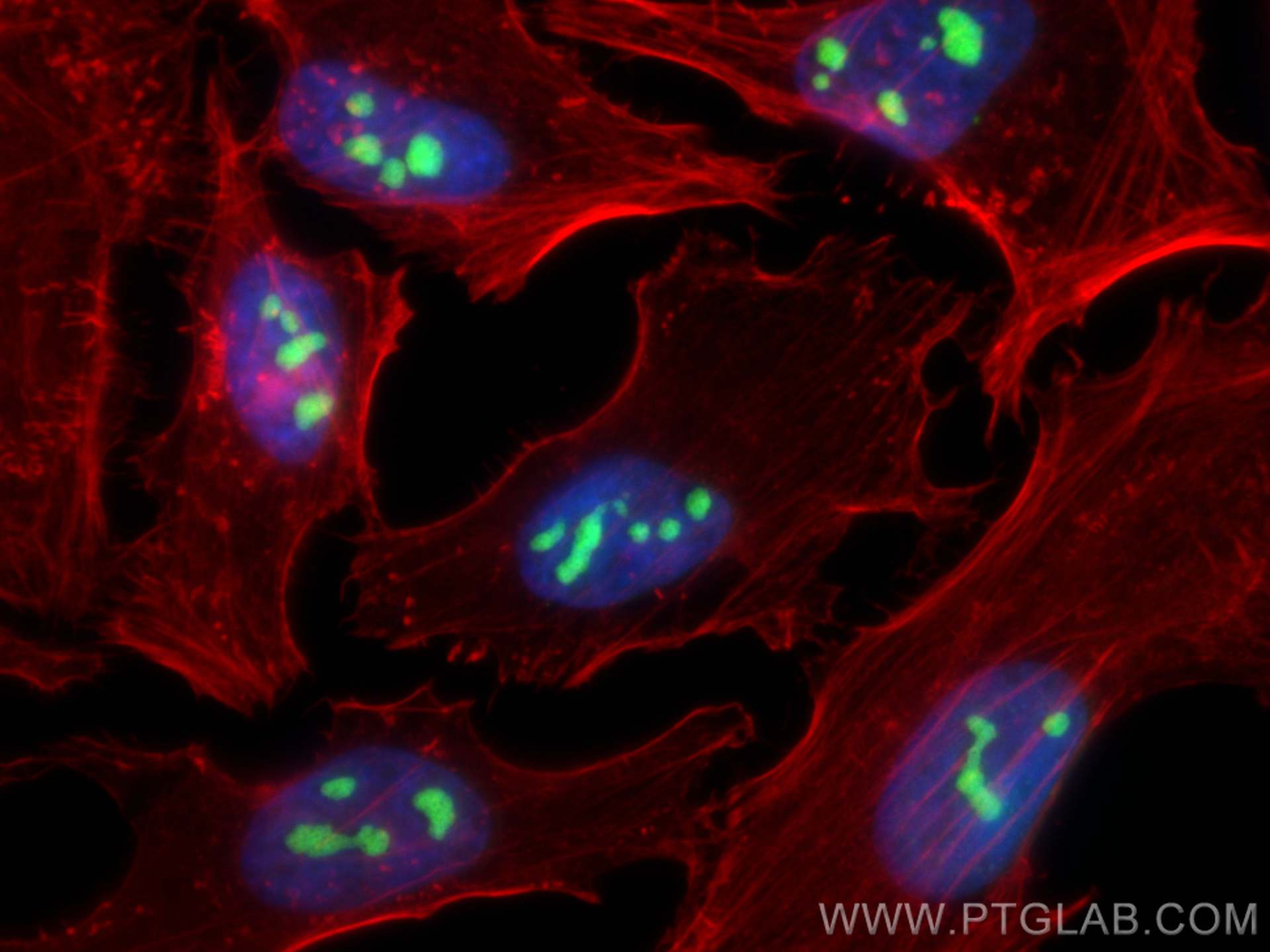 IF Staining of HeLa using 82585-1-RR (same clone as 82585-1-PBS)