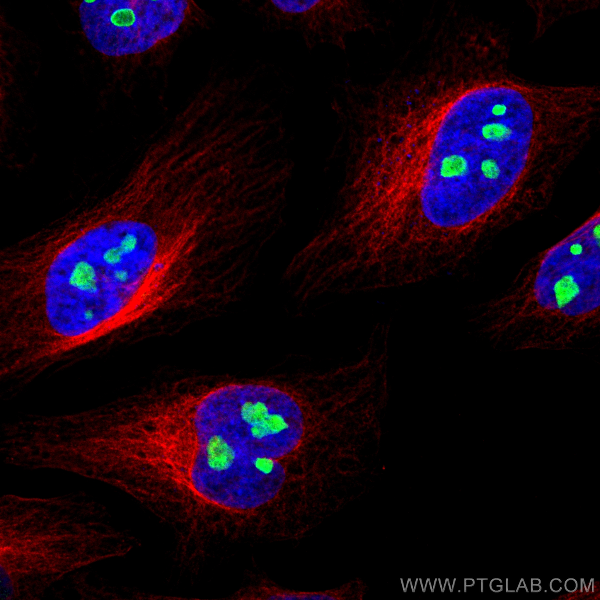 IF Staining of HeLa using 82585-1-RR (same clone as 82585-1-PBS)