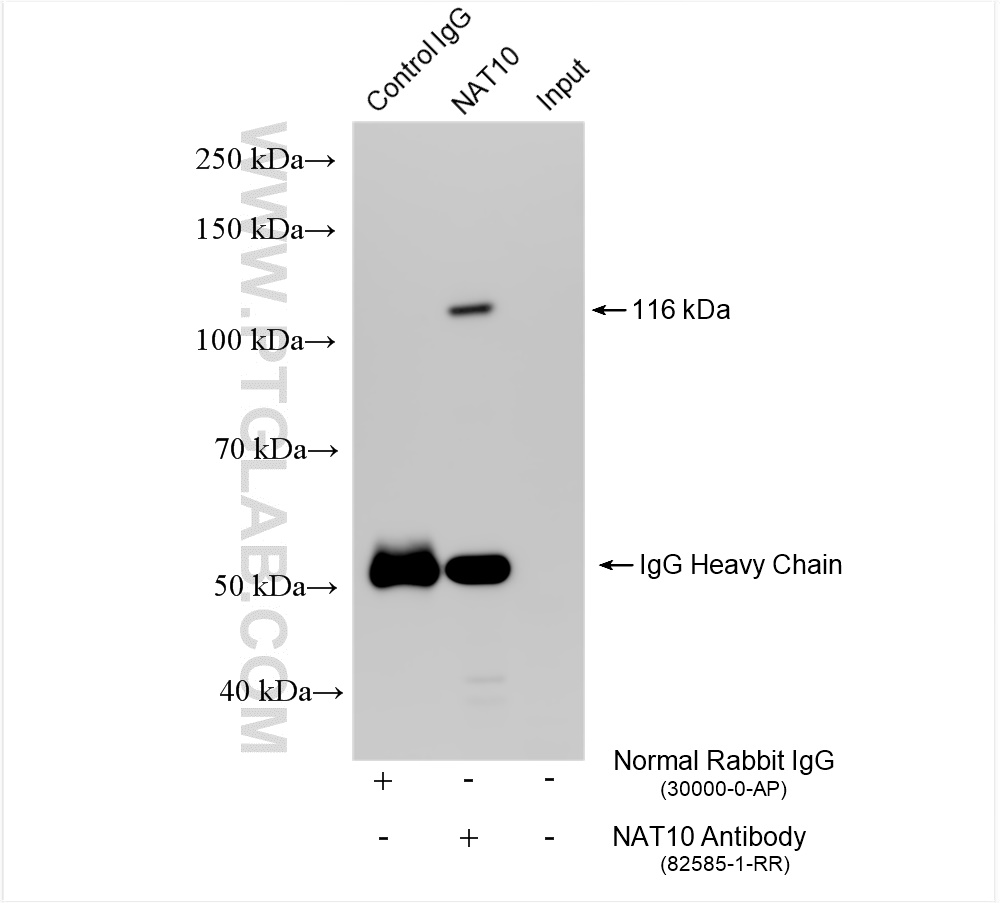 IP experiment of mouse testis using 82585-1-RR (same clone as 82585-1-PBS)