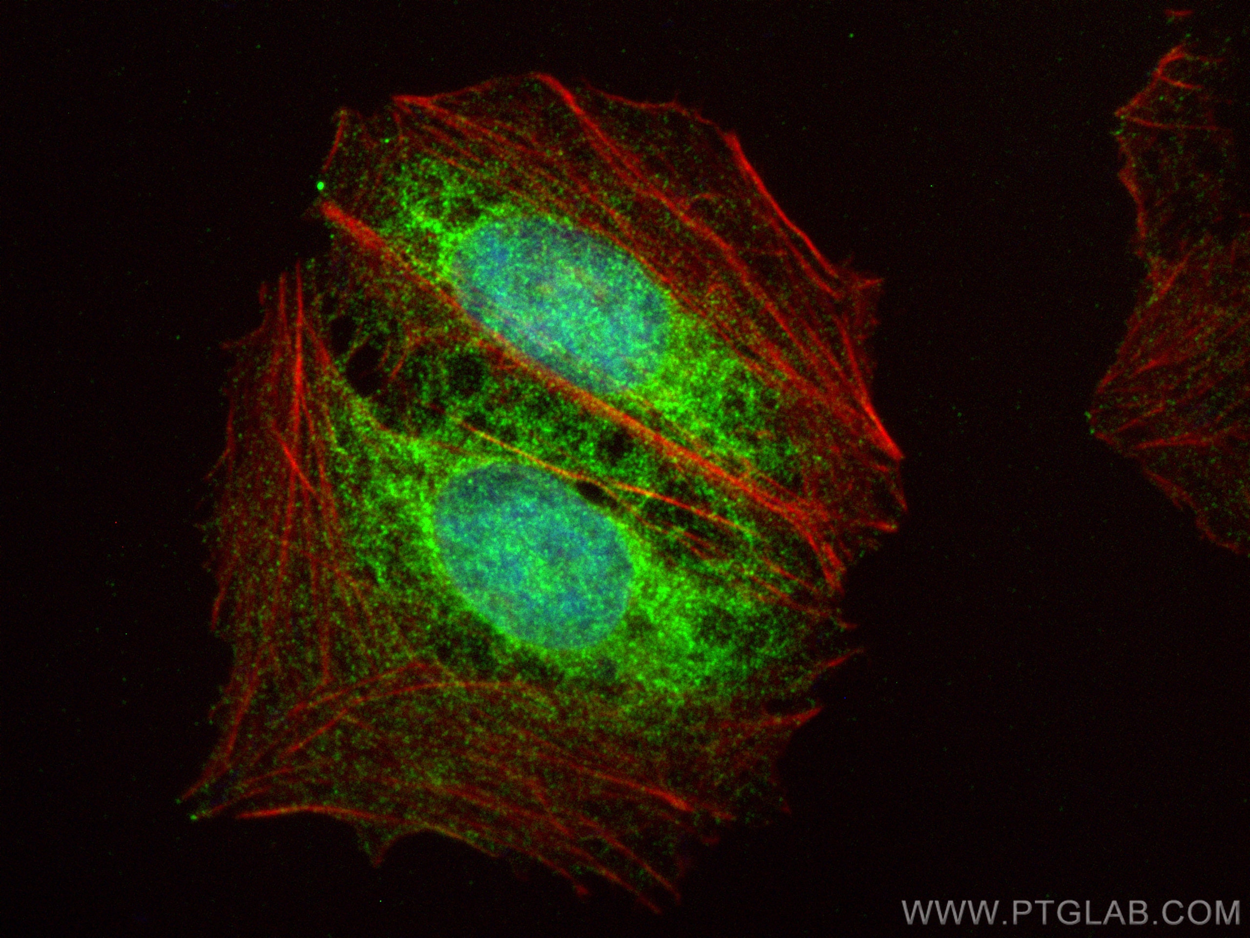 IF Staining of U2OS using 16698-1-AP