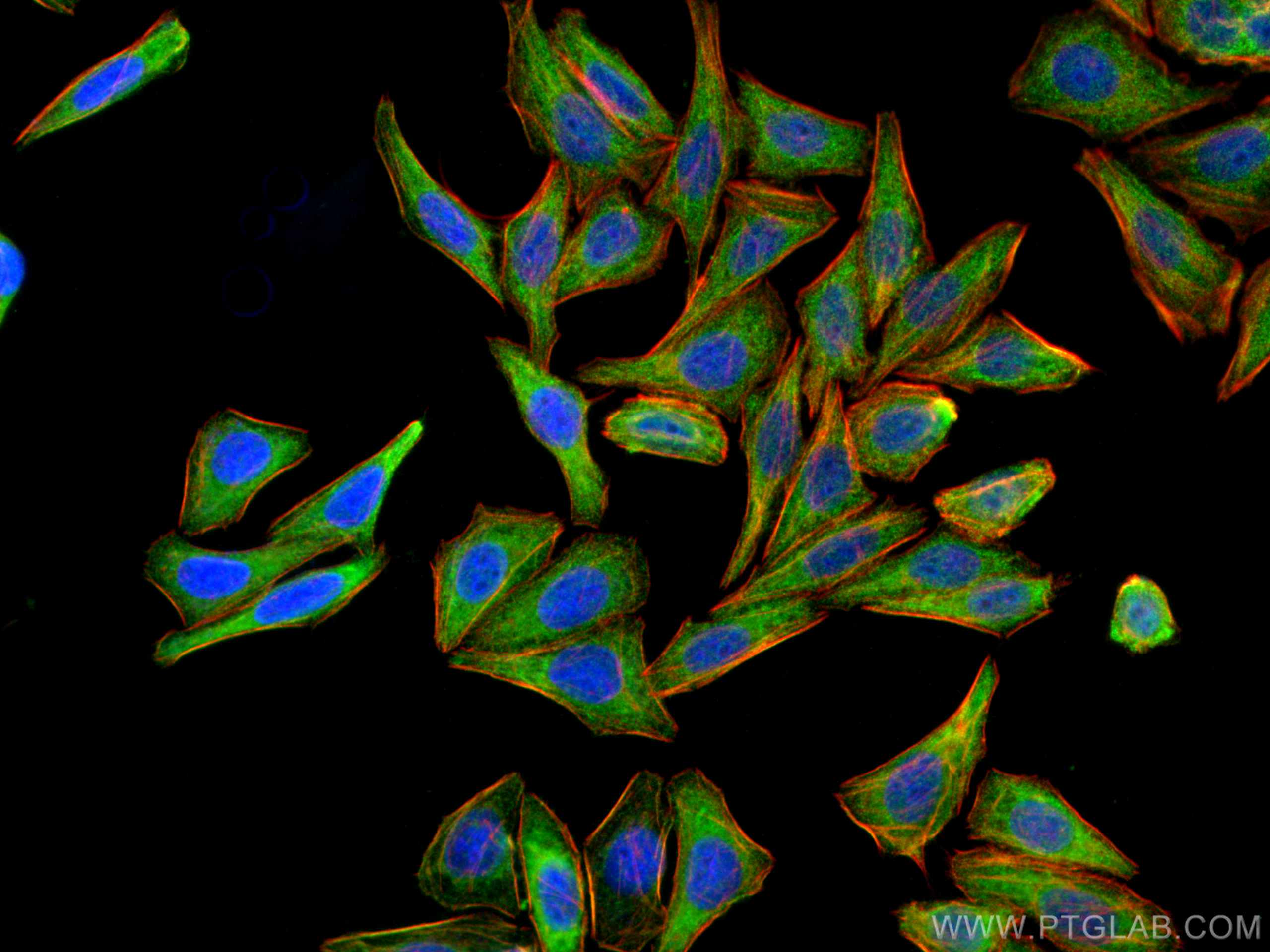 IF Staining of HepG2 using 26150-1-AP