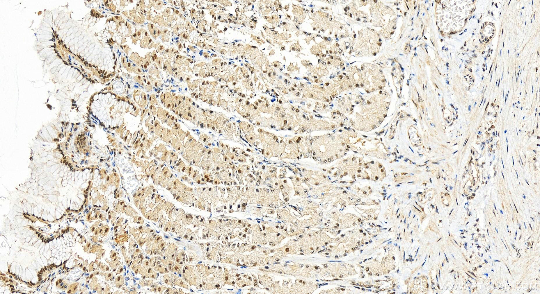 IHC staining of human stomach using 55025-1-AP