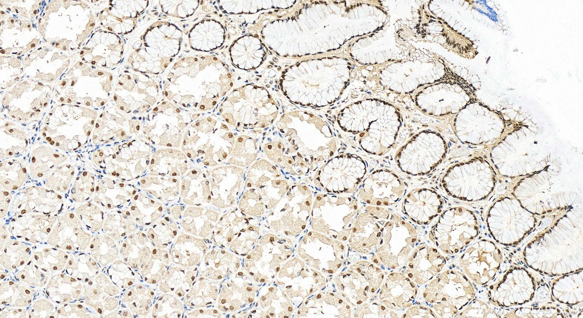 IHC staining of human stomach using 55025-1-AP