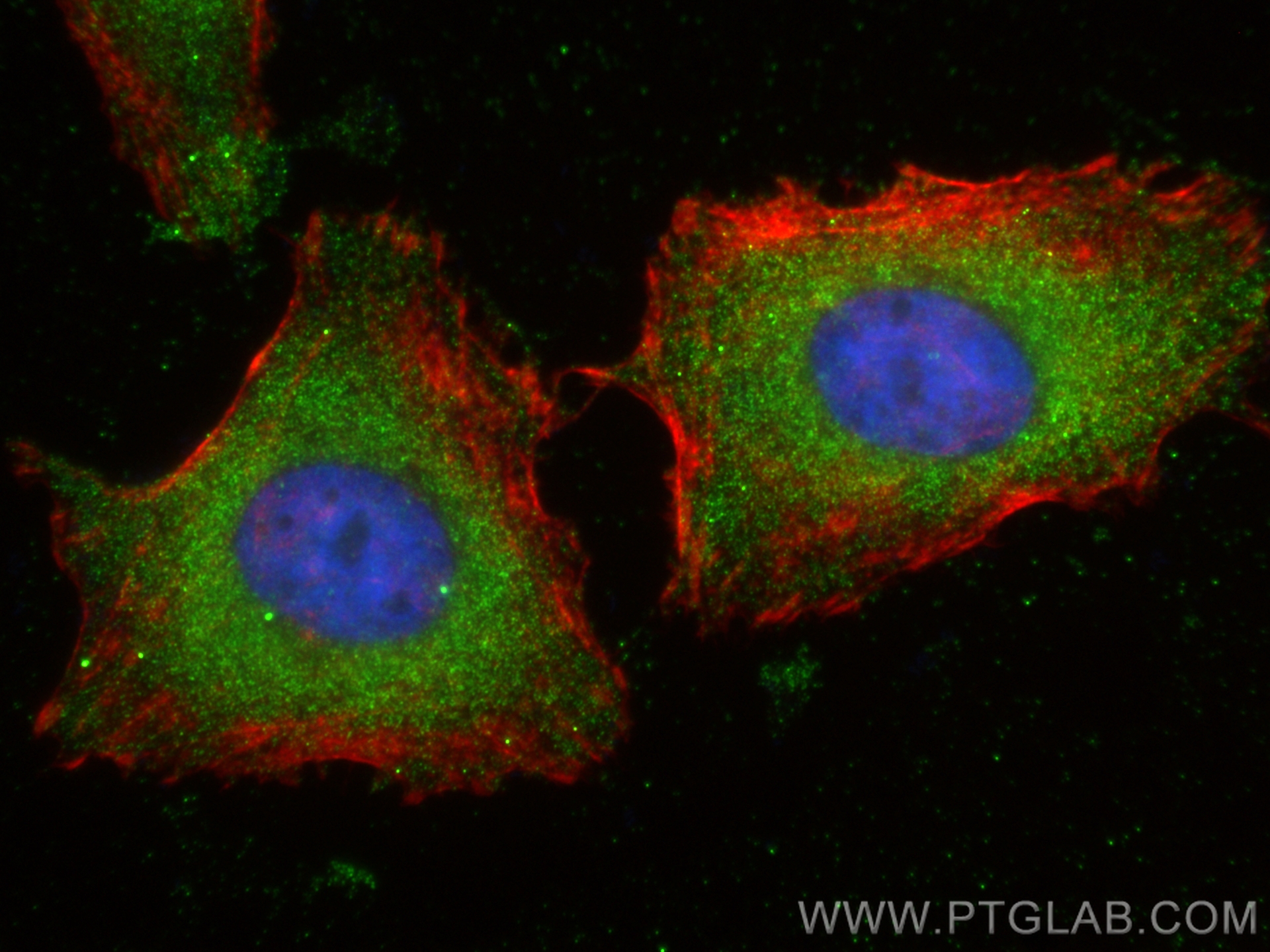 IF Staining of HeLa using CL488-68062