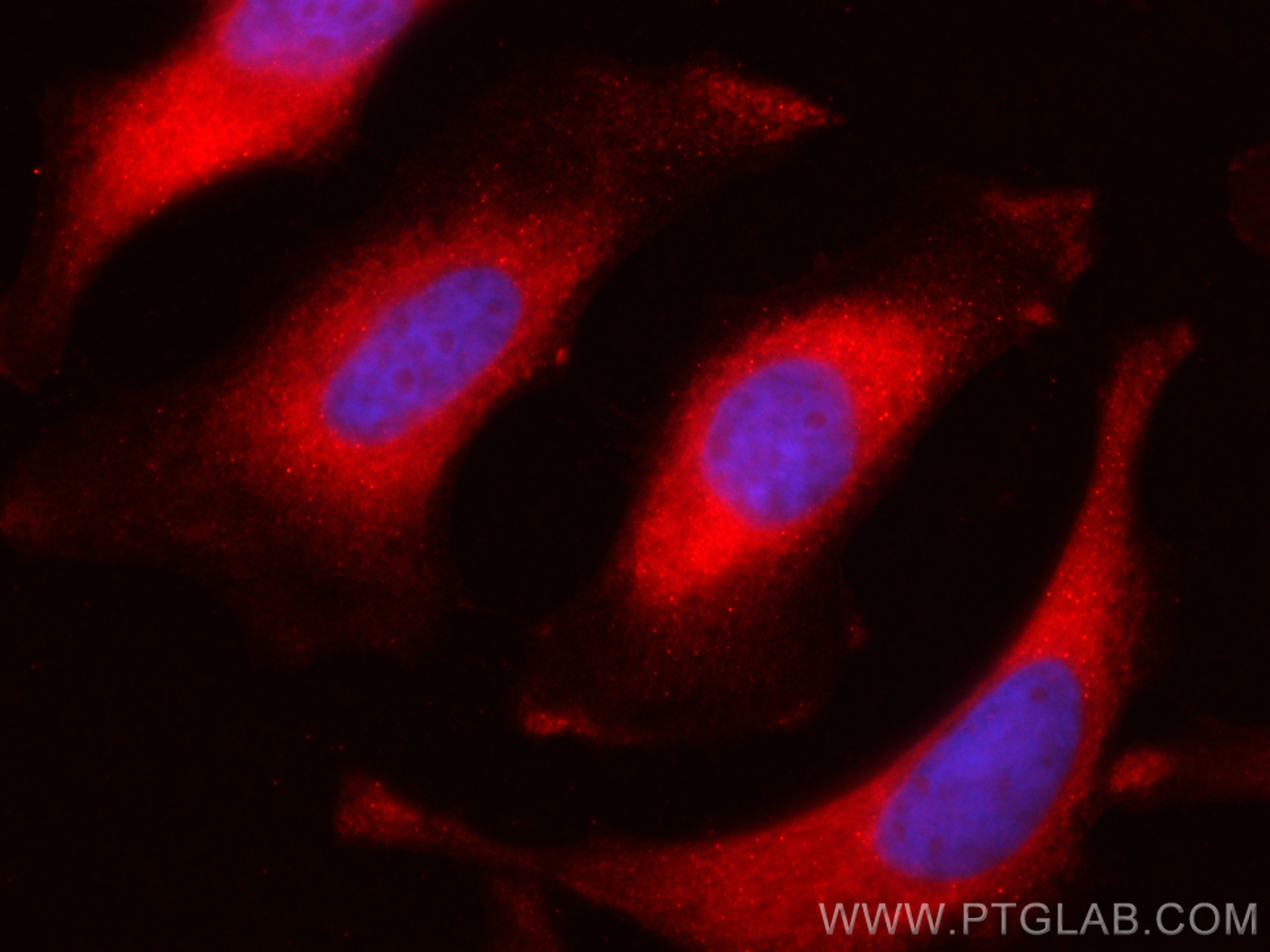 IF Staining of HeLa using CL594-16004