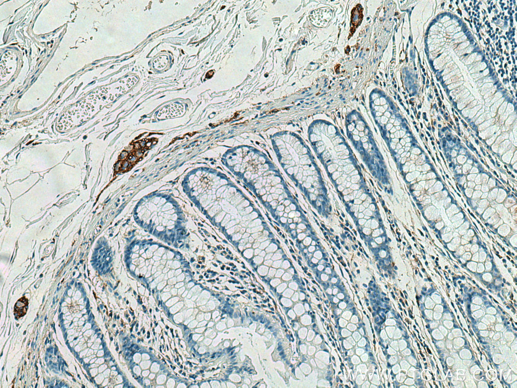 IHC staining of human colon using 60238-1-Ig (same clone as 60238-1-PBS)