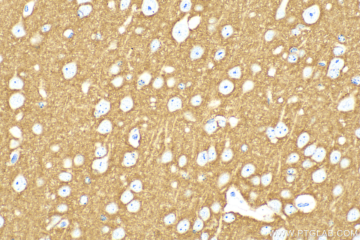 IHC staining of mouse brain using 31536-1-AP