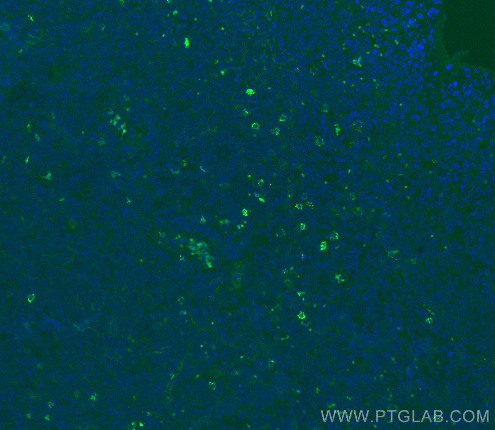 IF Staining of human tonsillitis using 82715-3-RR