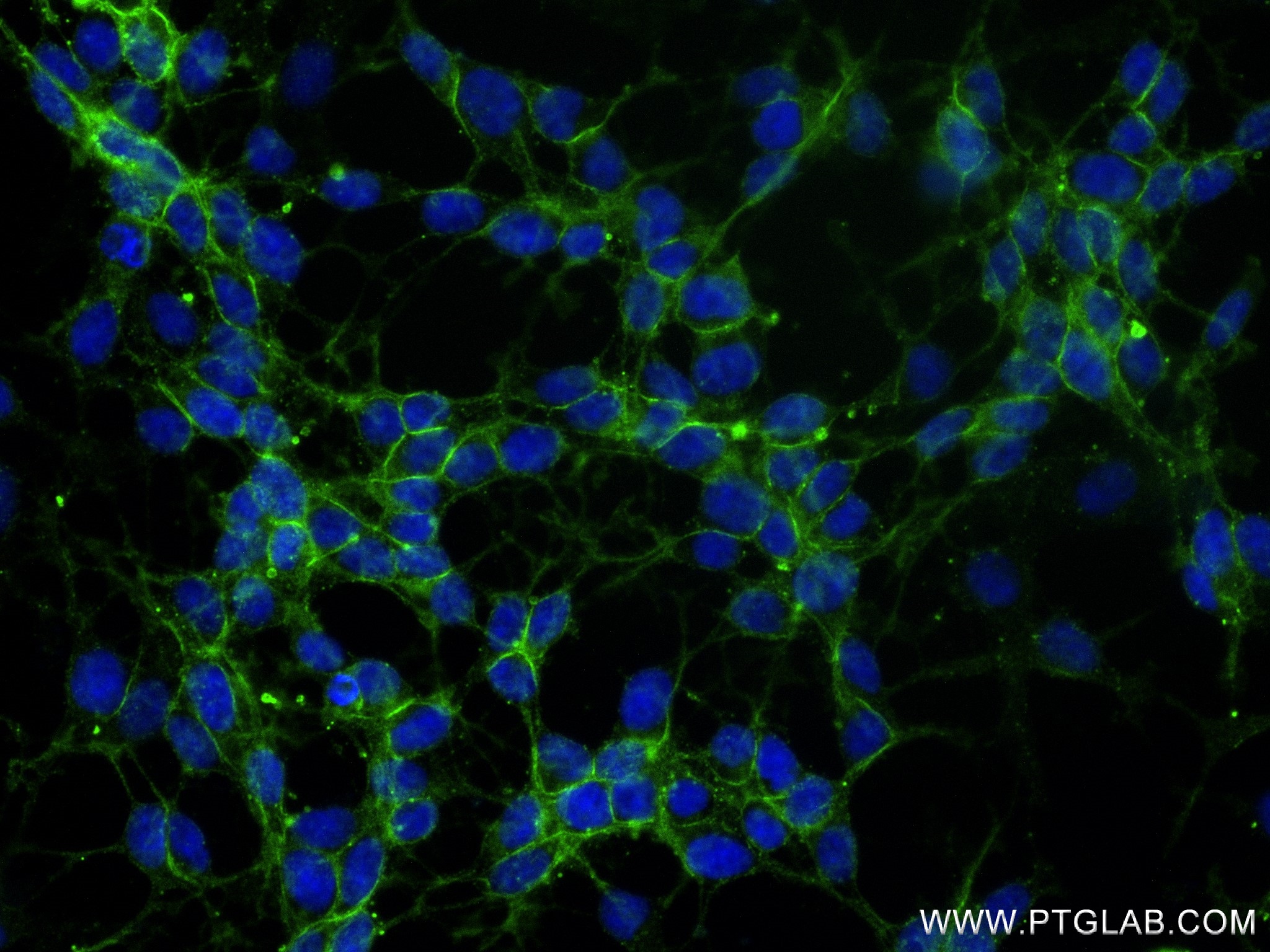 IF Staining of SH-SY5Y using 83365-6-RR (same clone as 83365-6-PBS)