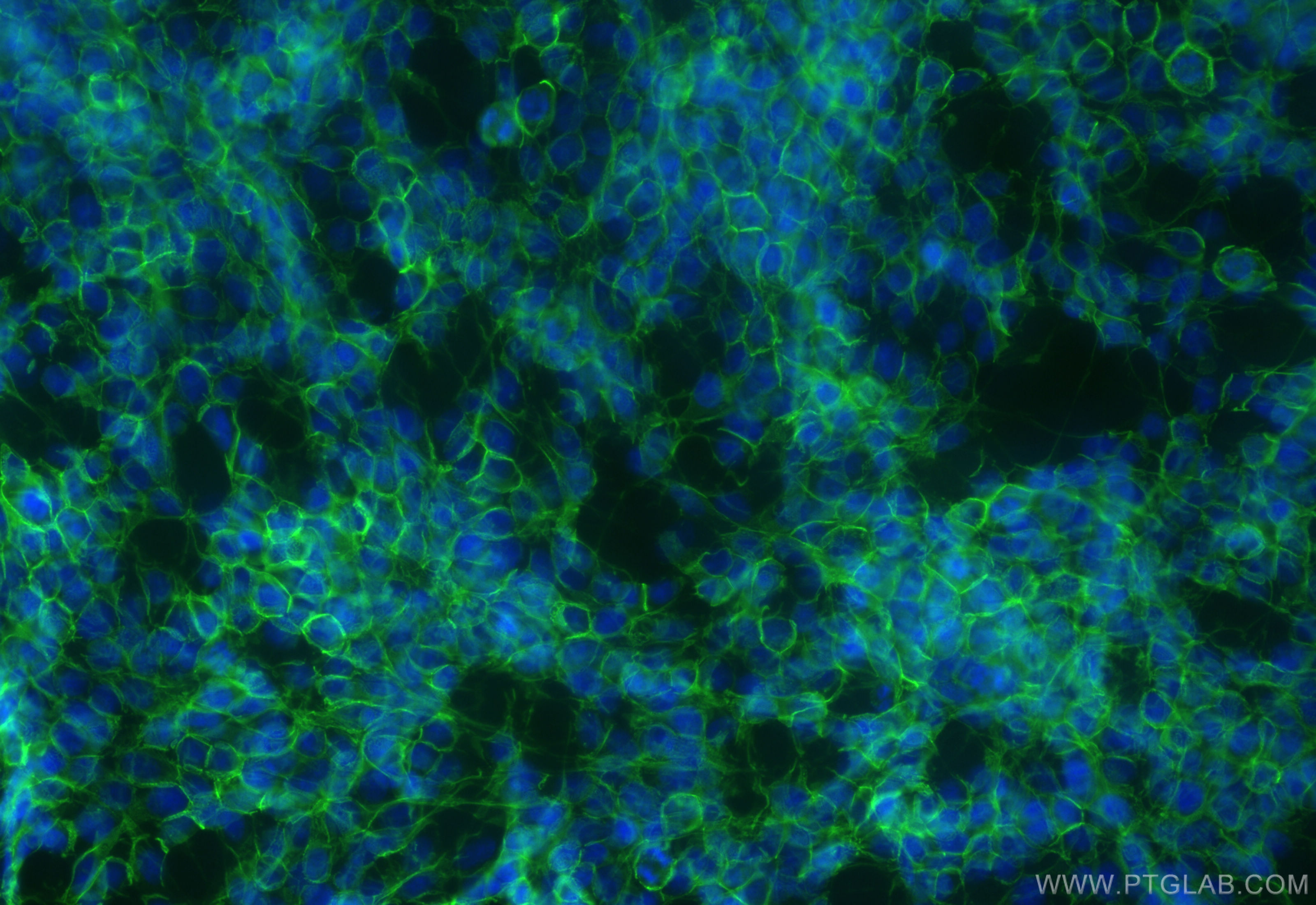 IF Staining of SH-SY5Y using CL488-83365-6