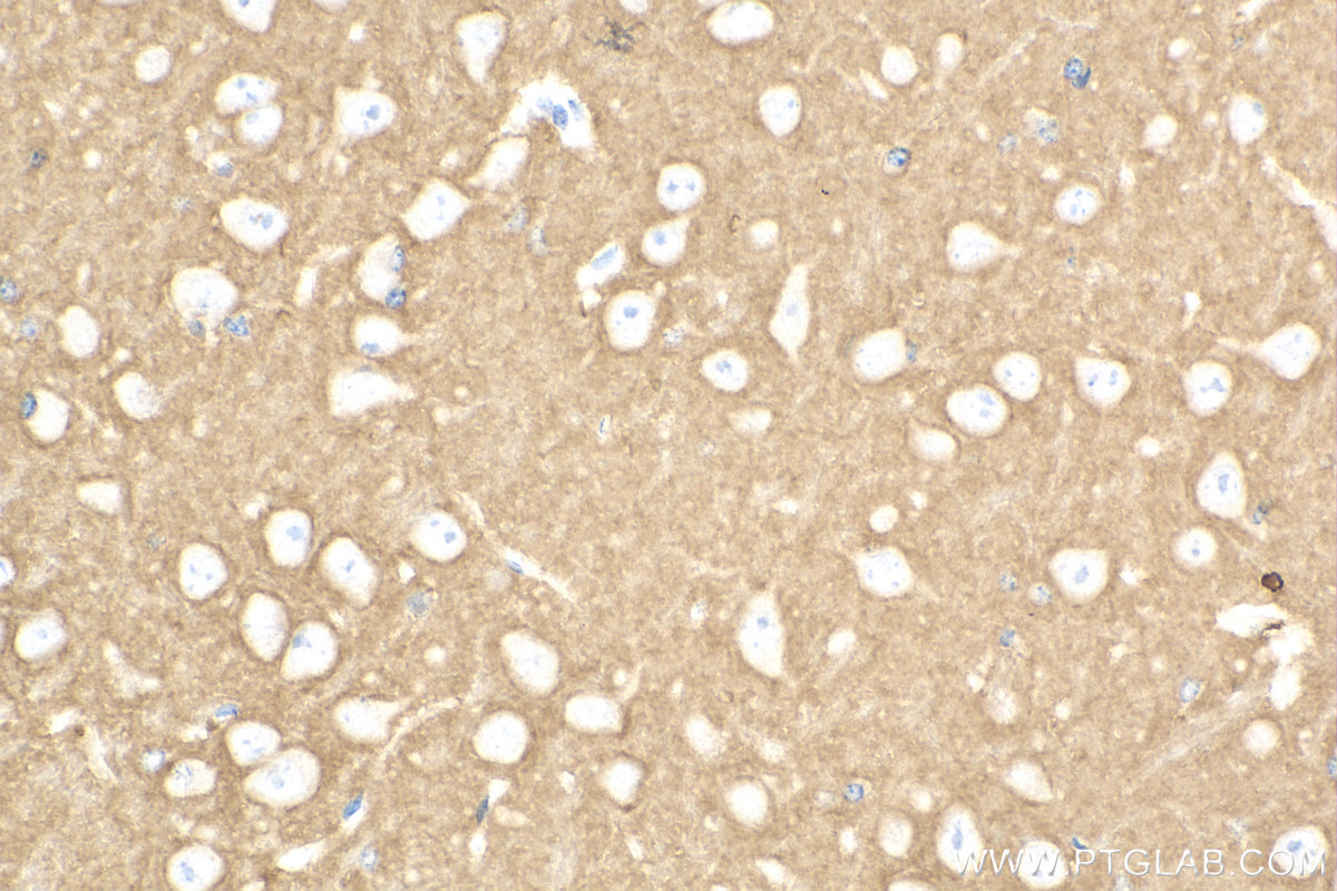 IHC staining of mouse brain using 13850-1-AP