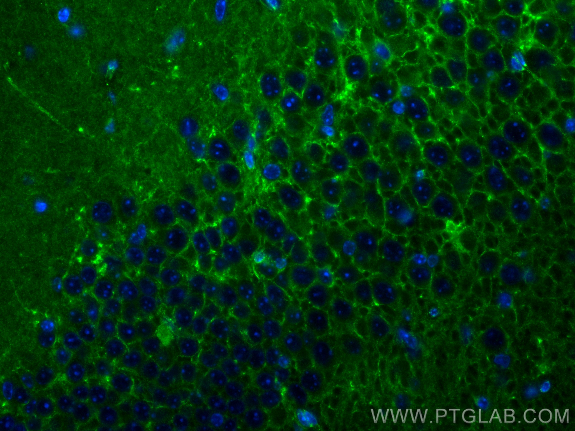 IF Staining of mouse brain using 83494-6-RR