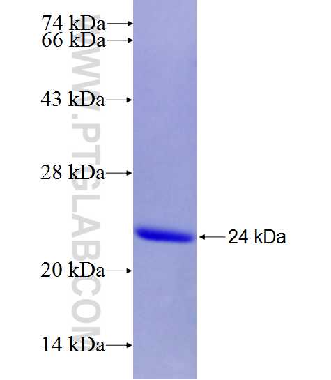 NCF1 fusion protein Ag28101 SDS-PAGE