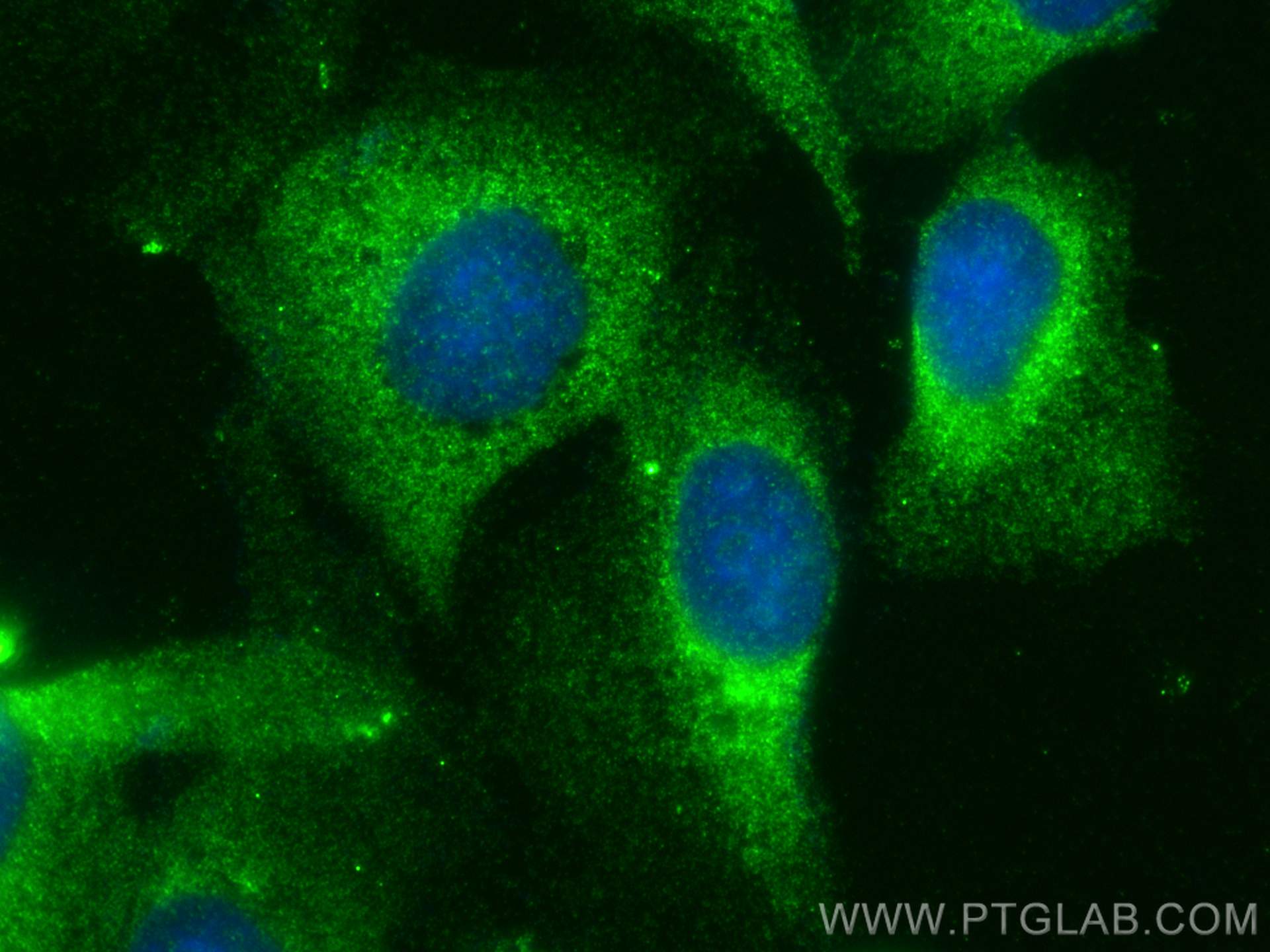 IF Staining of U2OS using 14648-1-AP