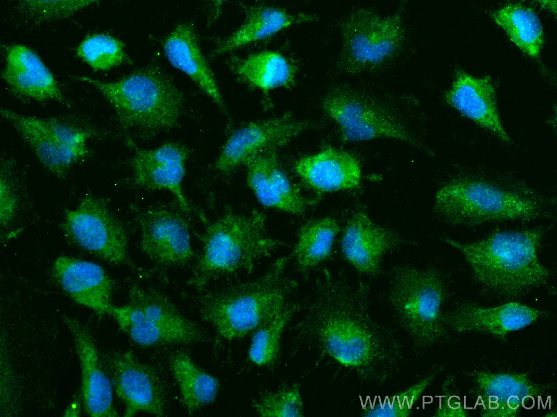 IF Staining of U-251 using 12140-1-AP