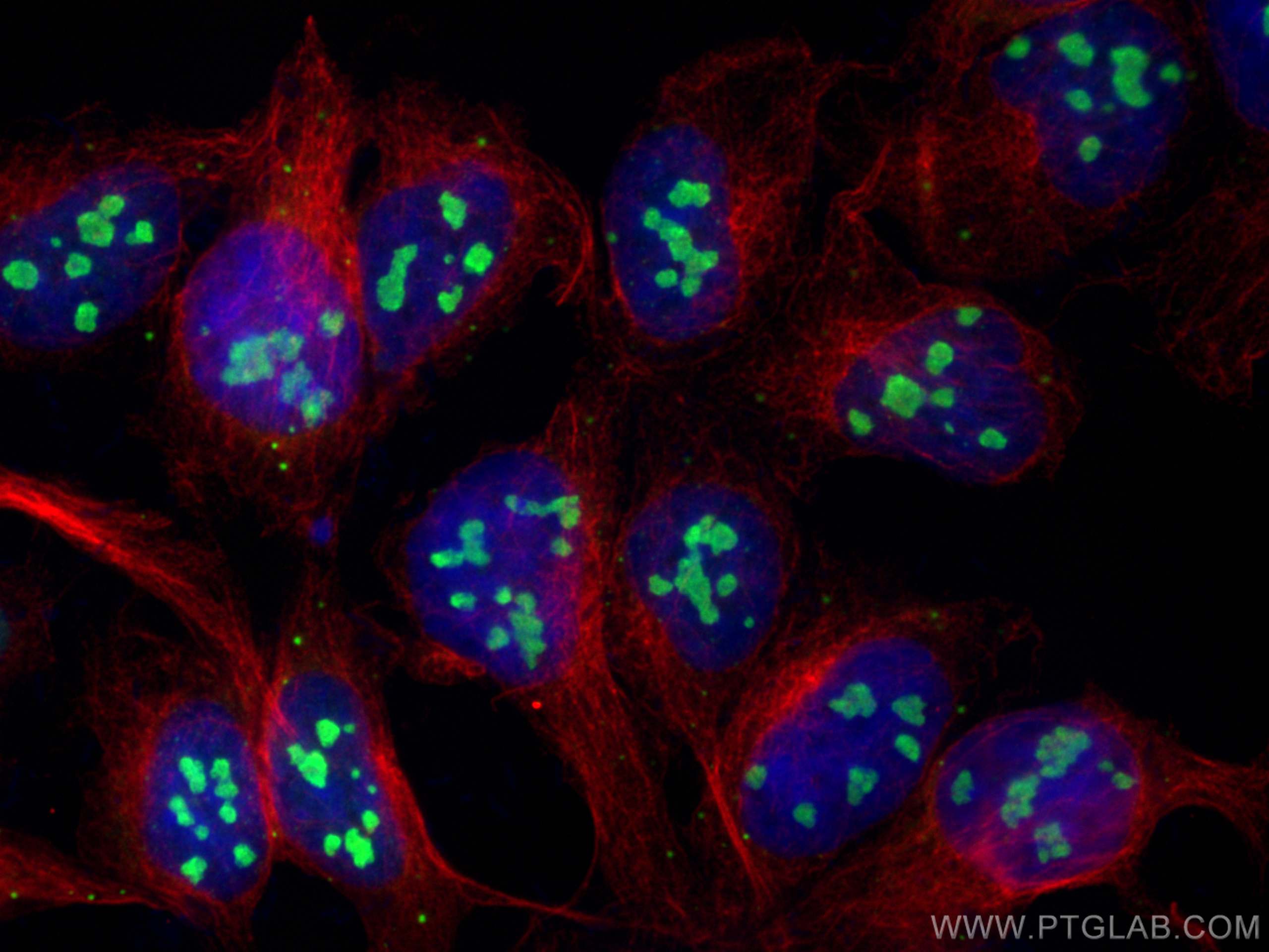 IF Staining of HEK-293 using 10556-1-AP