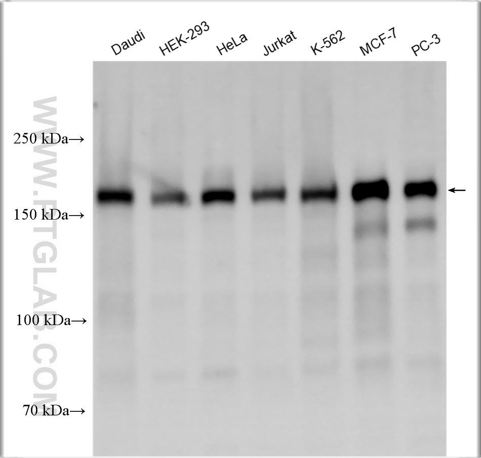 WB analysis using 29587-1-AP (same clone as 29587-1-PBS)