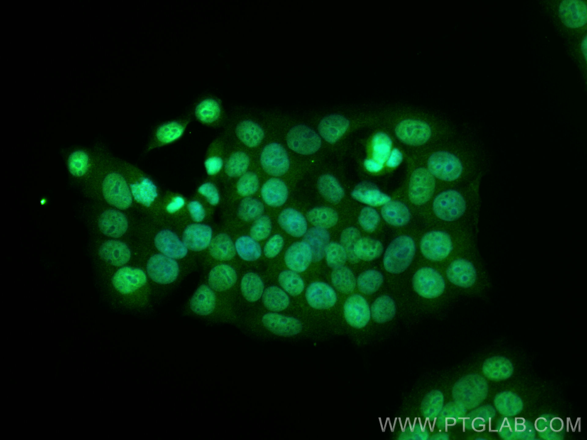 IF Staining of MCF-7 using 10968-1-AP