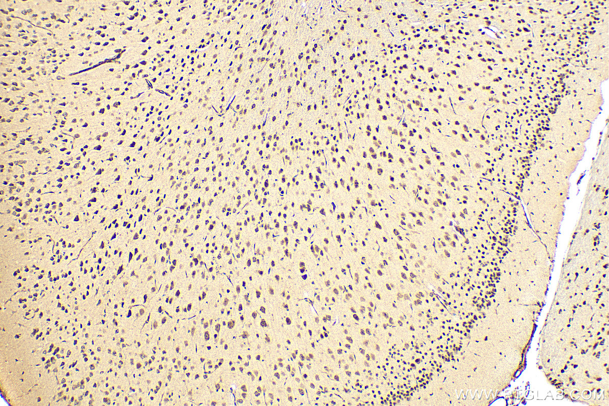 IHC staining of mouse brain using 10968-1-AP