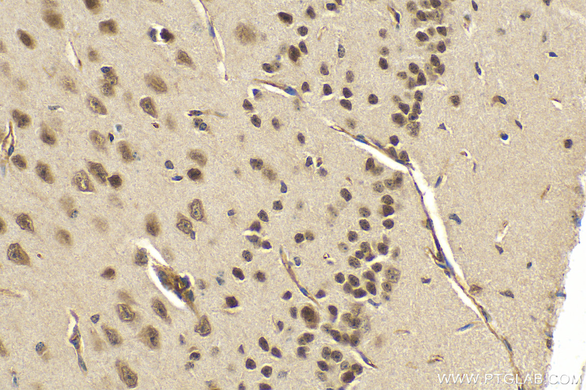 IHC staining of mouse brain using 10968-1-AP