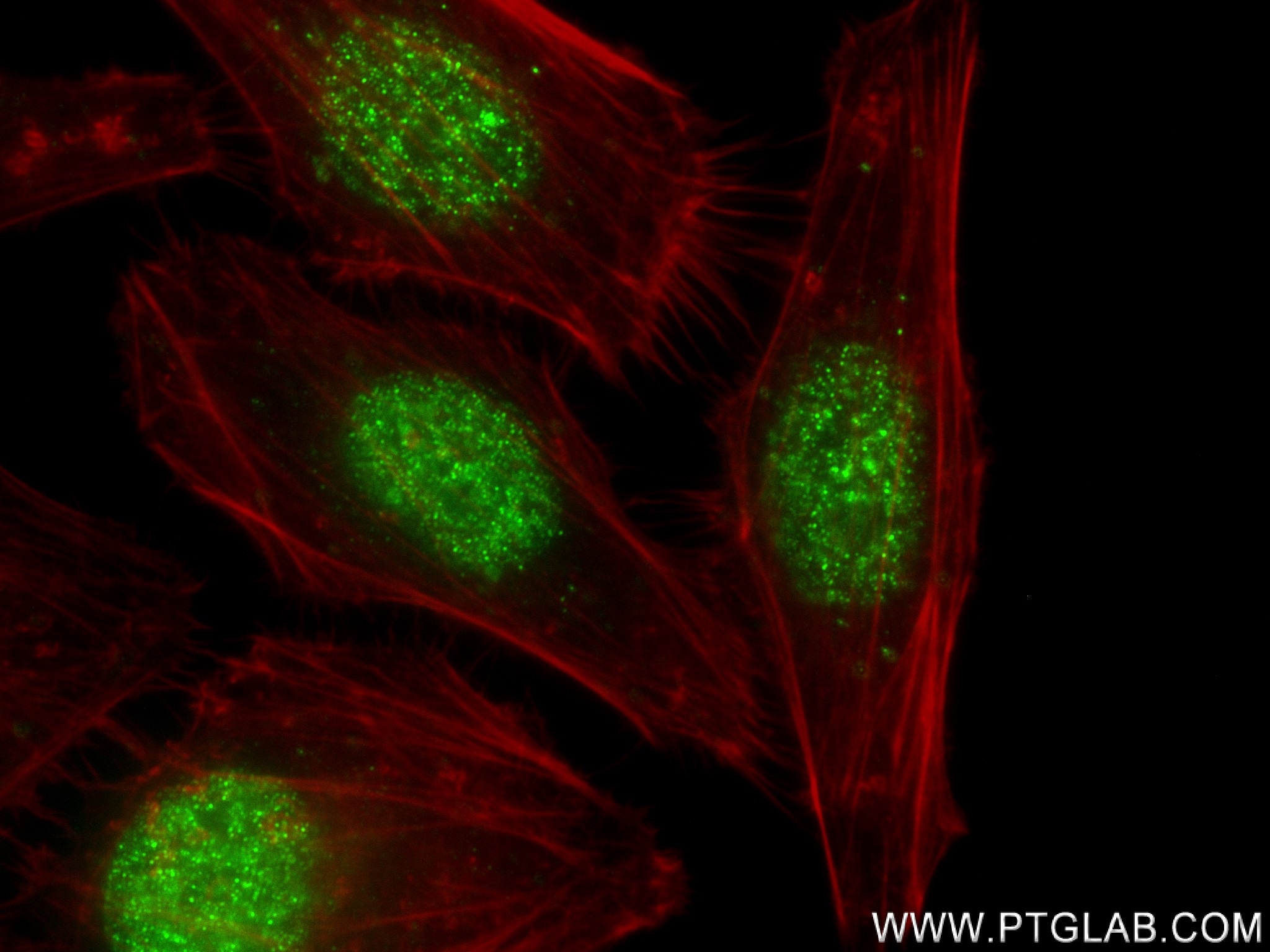 IF Staining of HepG2 using 83394-4-RR