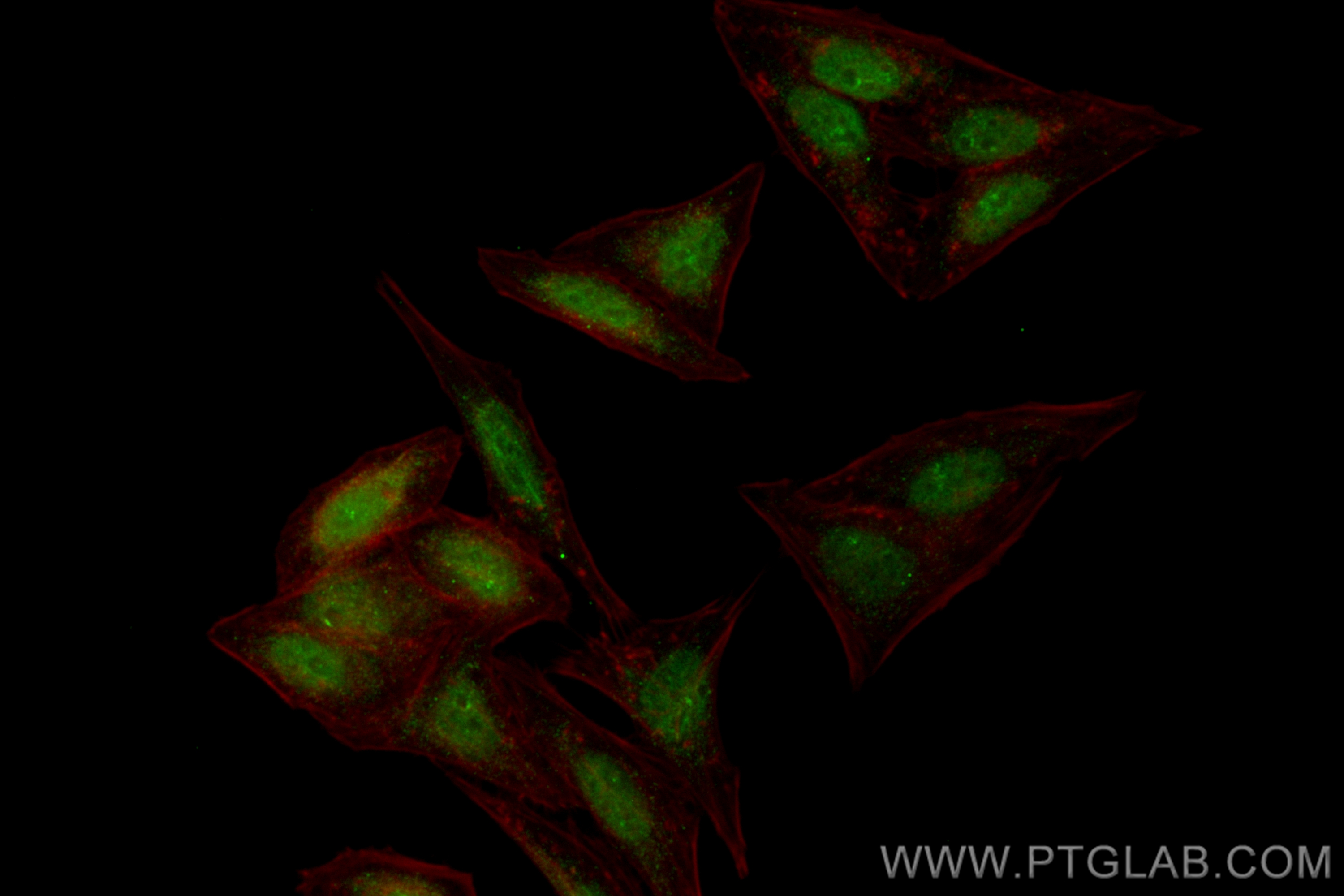 IF Staining of HepG2 using CL488-83394-4