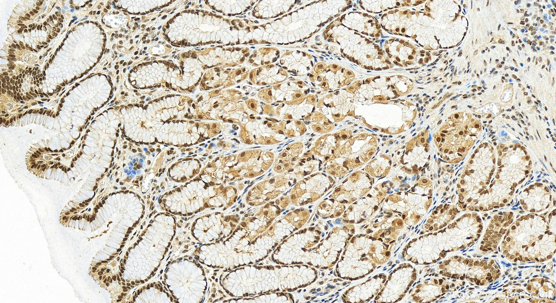 IHC staining of human stomach using 20175-1-AP