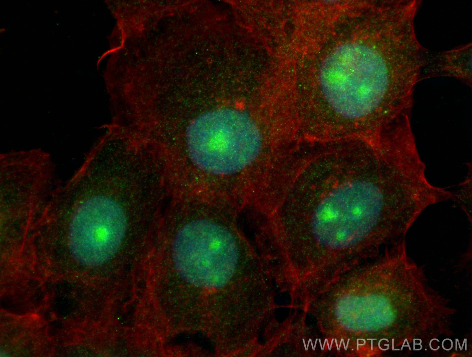 IF Staining of A431 using 20175-1-AP