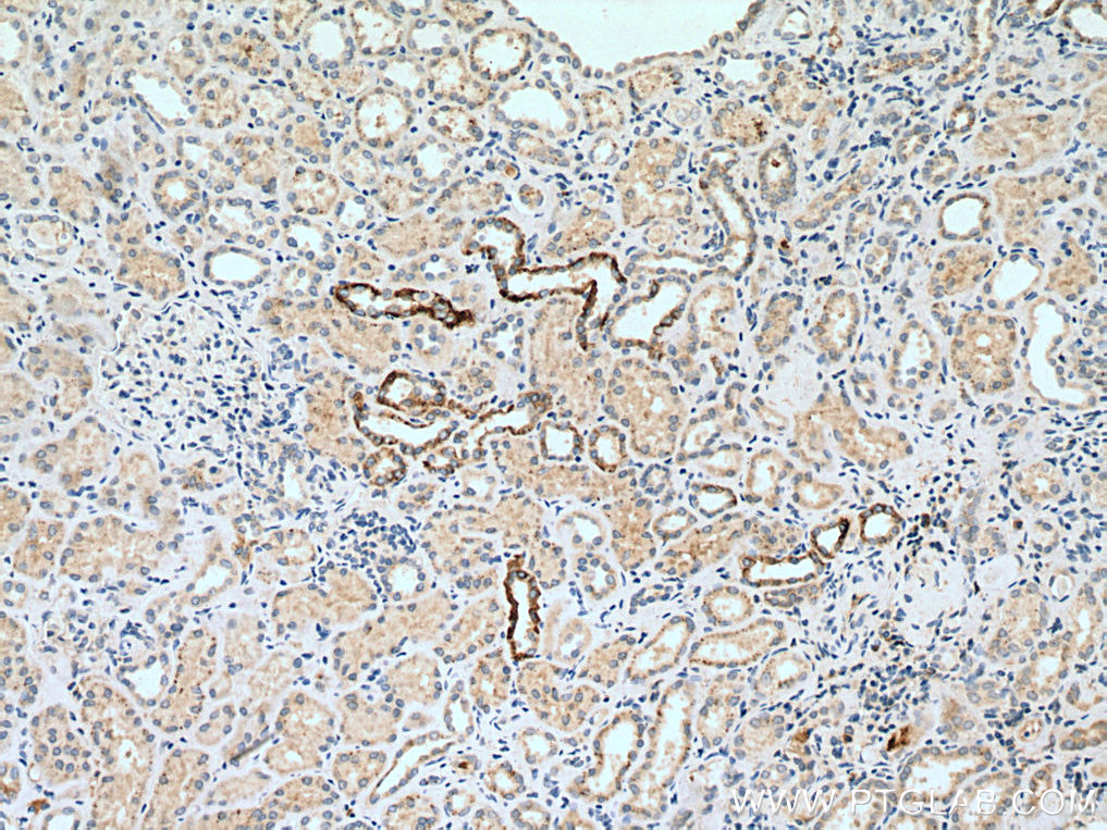 IHC staining of human kidney using 28447-1-AP (same clone as 28447-1-PBS)