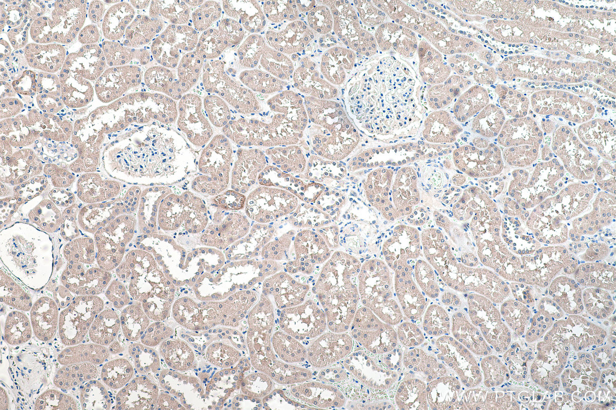 IHC staining of human kidney using 28447-1-AP (same clone as 28447-1-PBS)