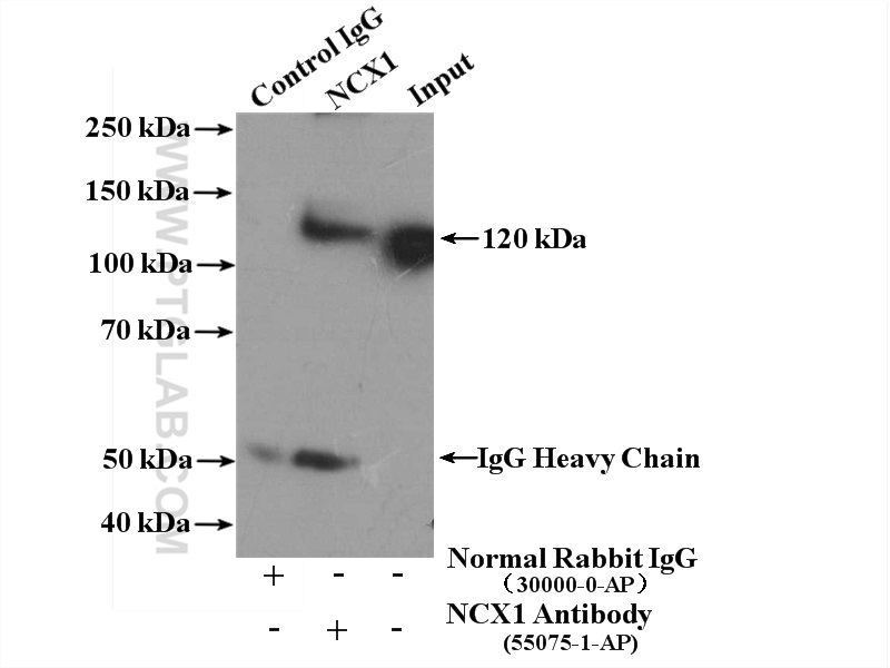 IP experiment of mouse brain using 55075-1-AP