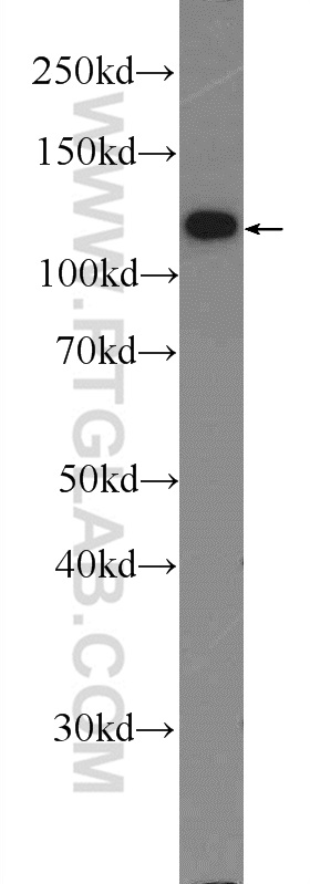 WB analysis of mouse brain using 55075-1-AP