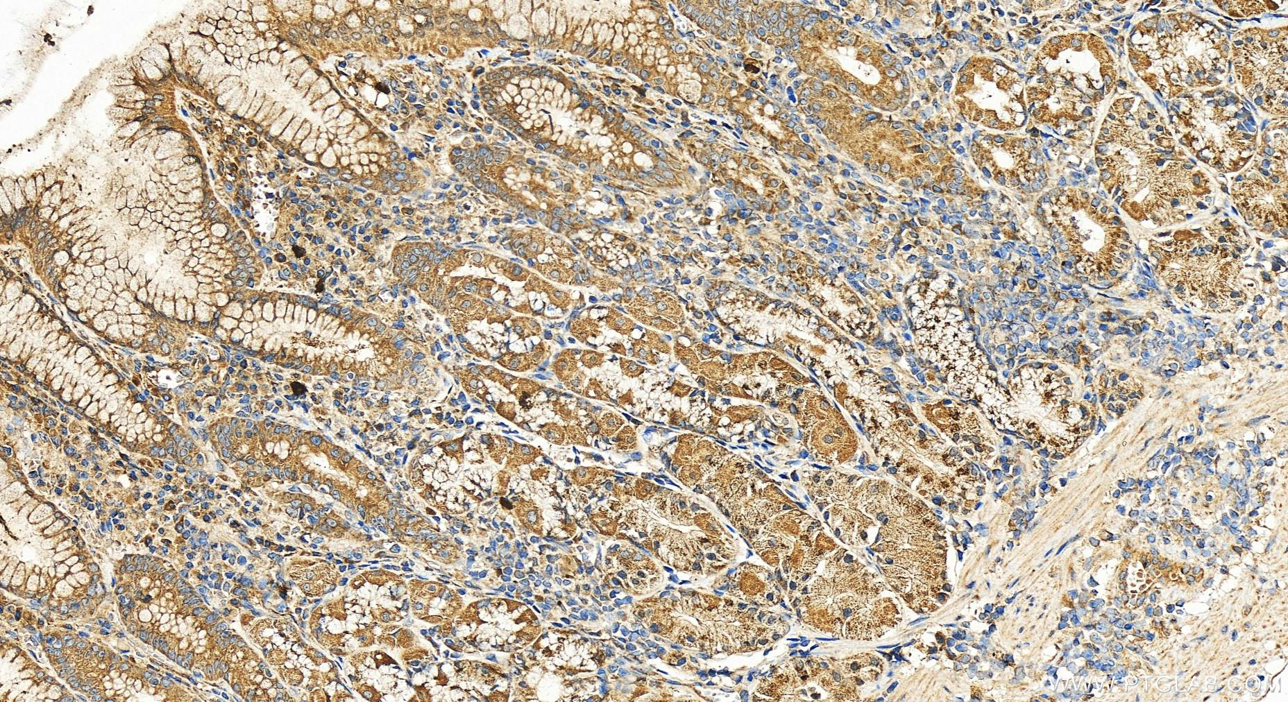 IHC staining of human stomach using 19704-1-AP