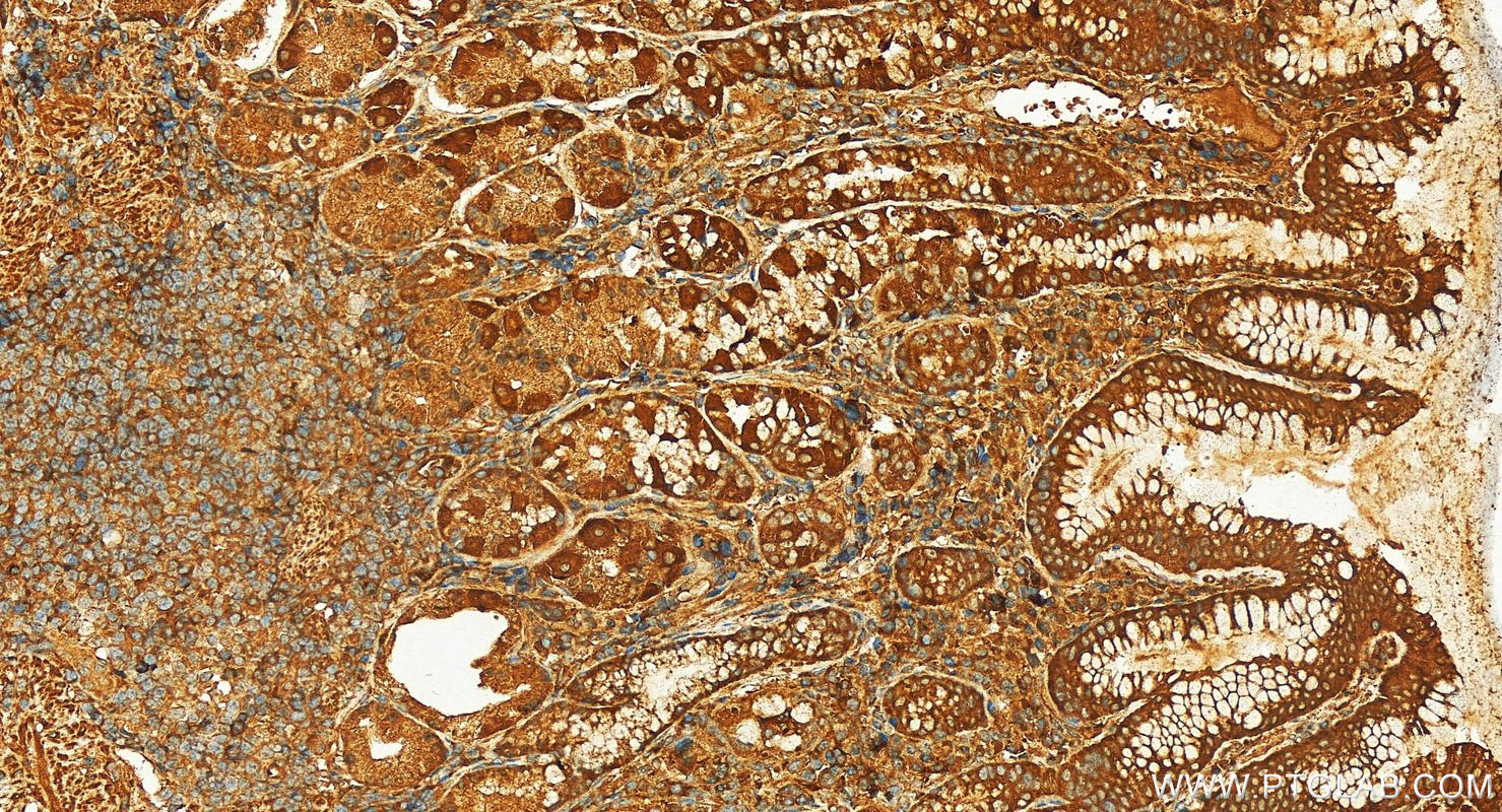 IHC staining of human stomach using 26736-1-AP