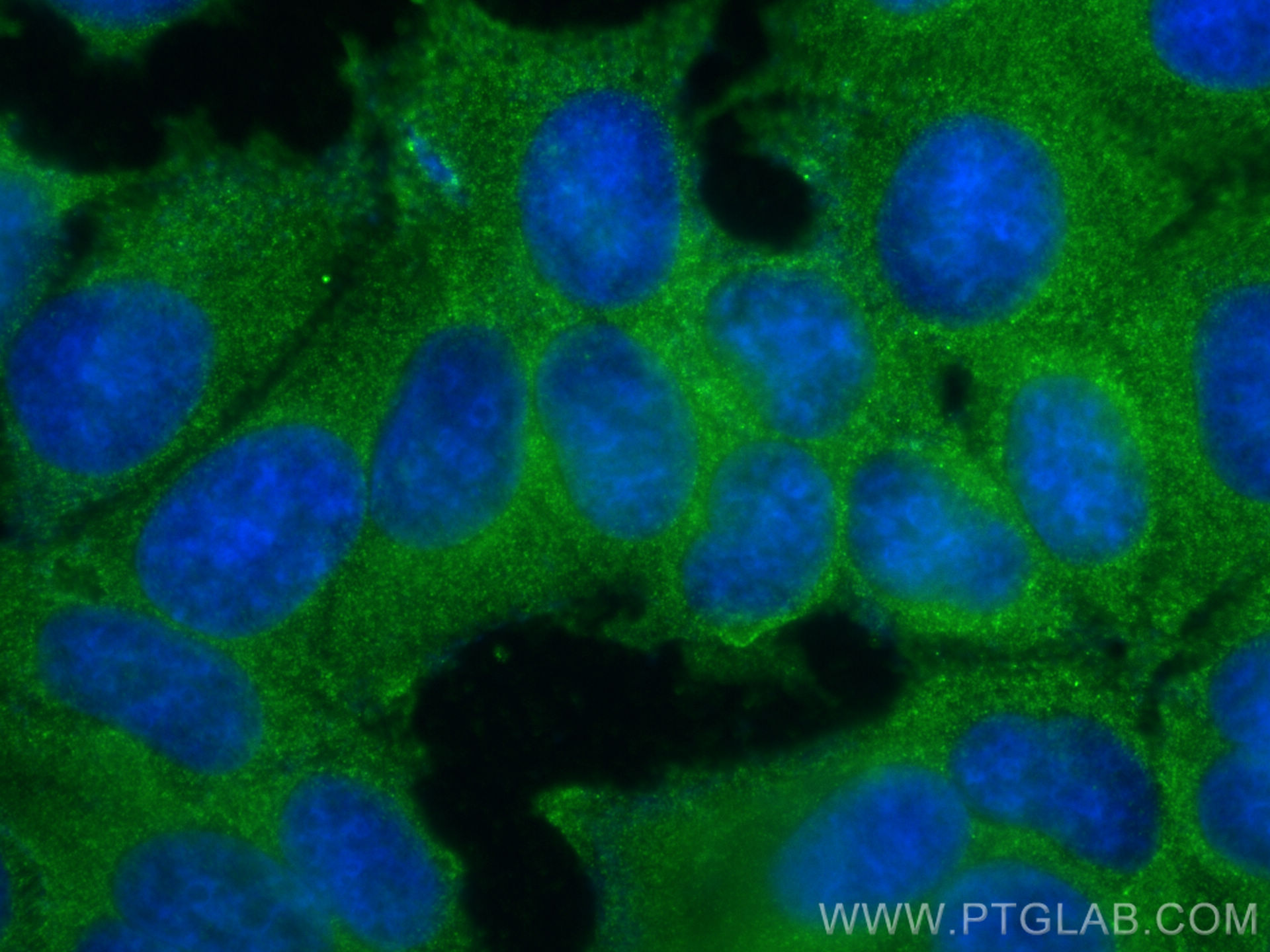 IF Staining of MCF-7 using 10233-1-AP