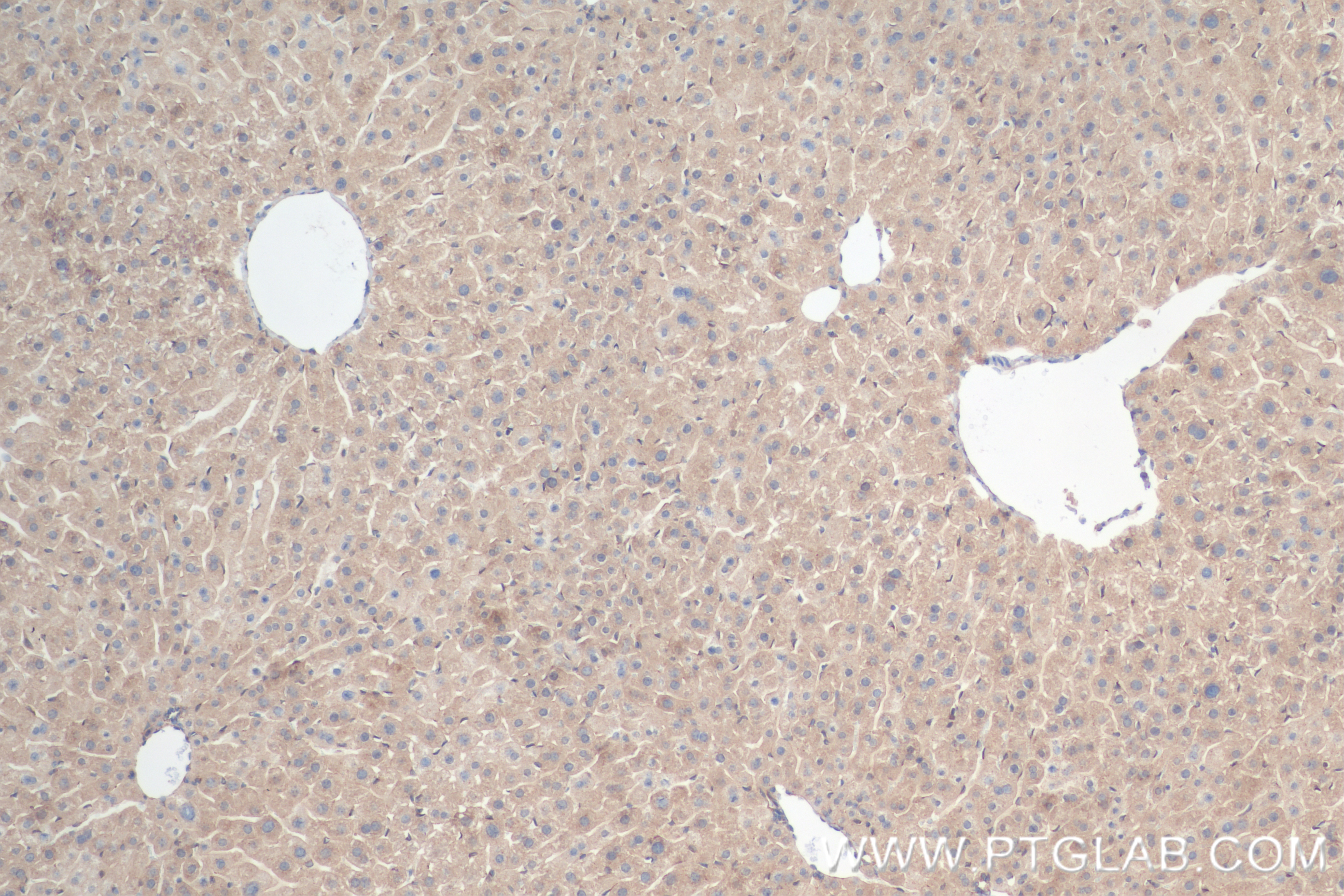 IHC staining of mouse liver using 84799-4-RR