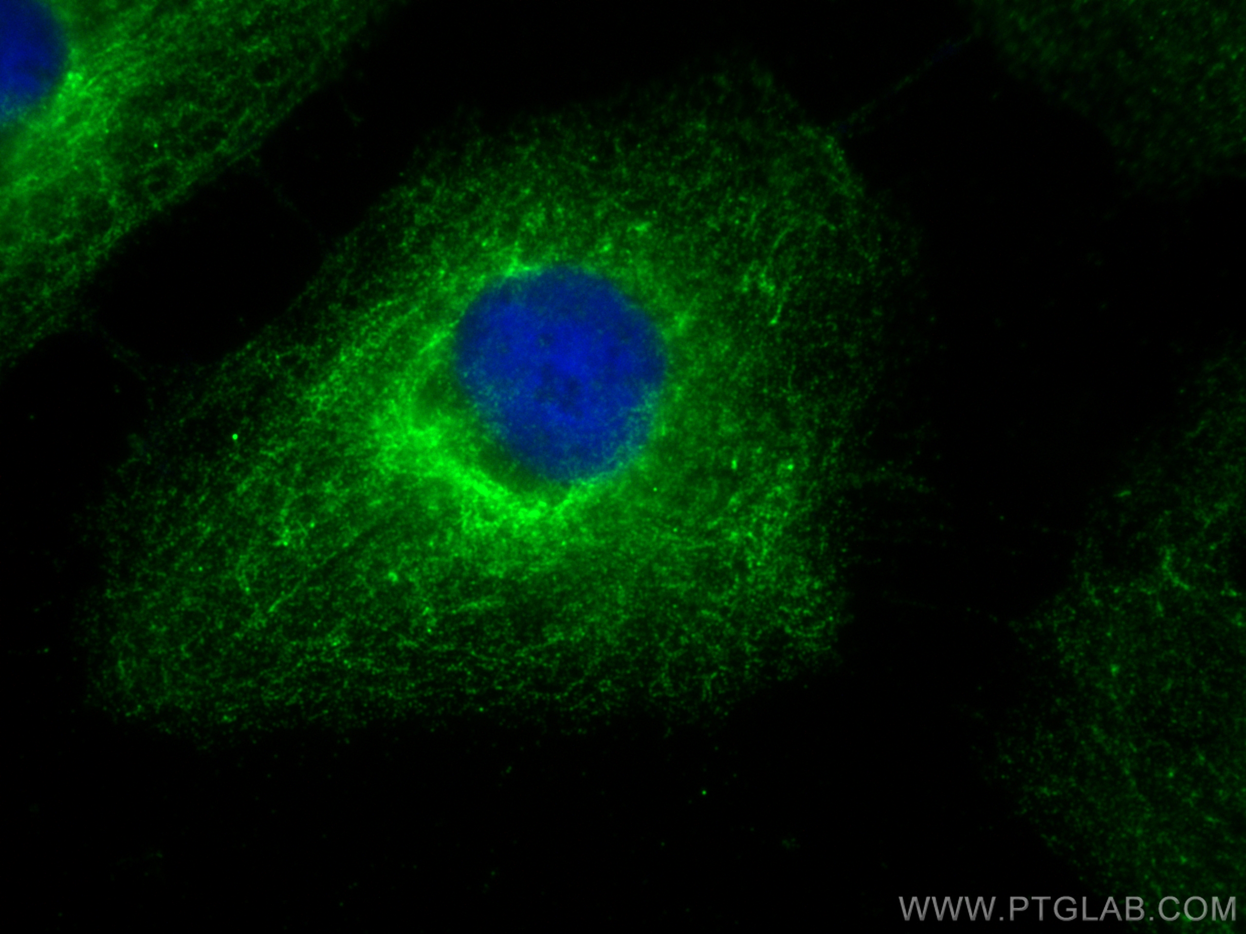 IF Staining of HeLa using CL488-12229