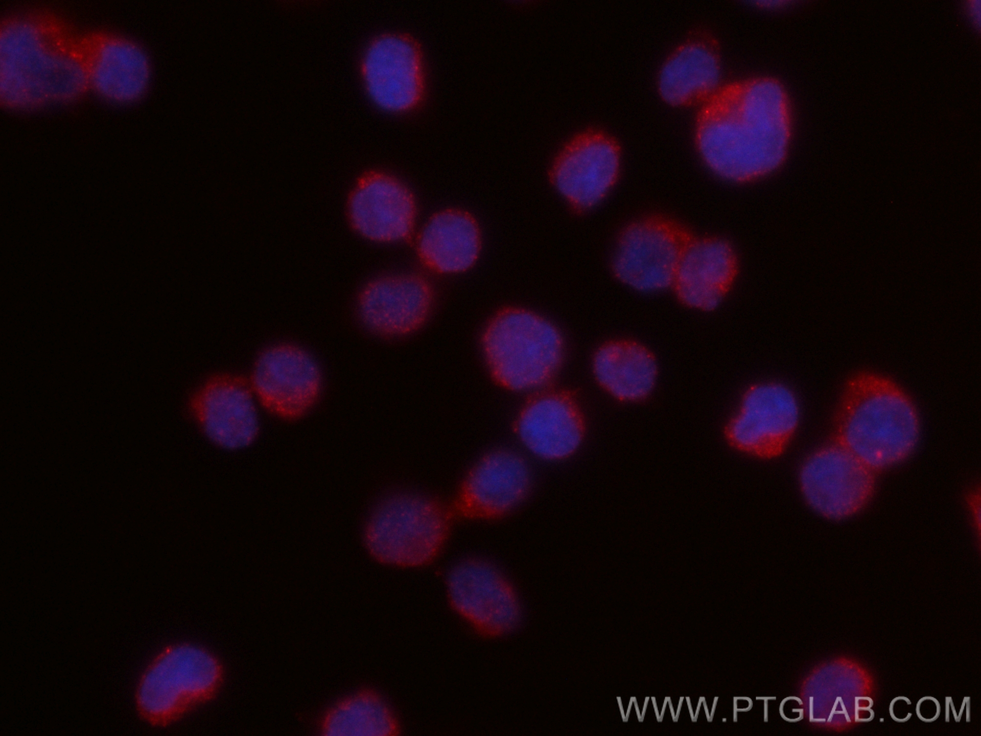 IF Staining of Jurkat using CL594-66401