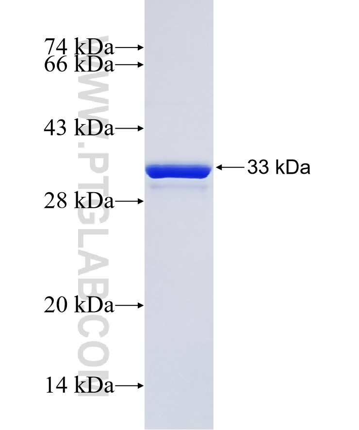 NDRG1 fusion protein Ag25424 SDS-PAGE