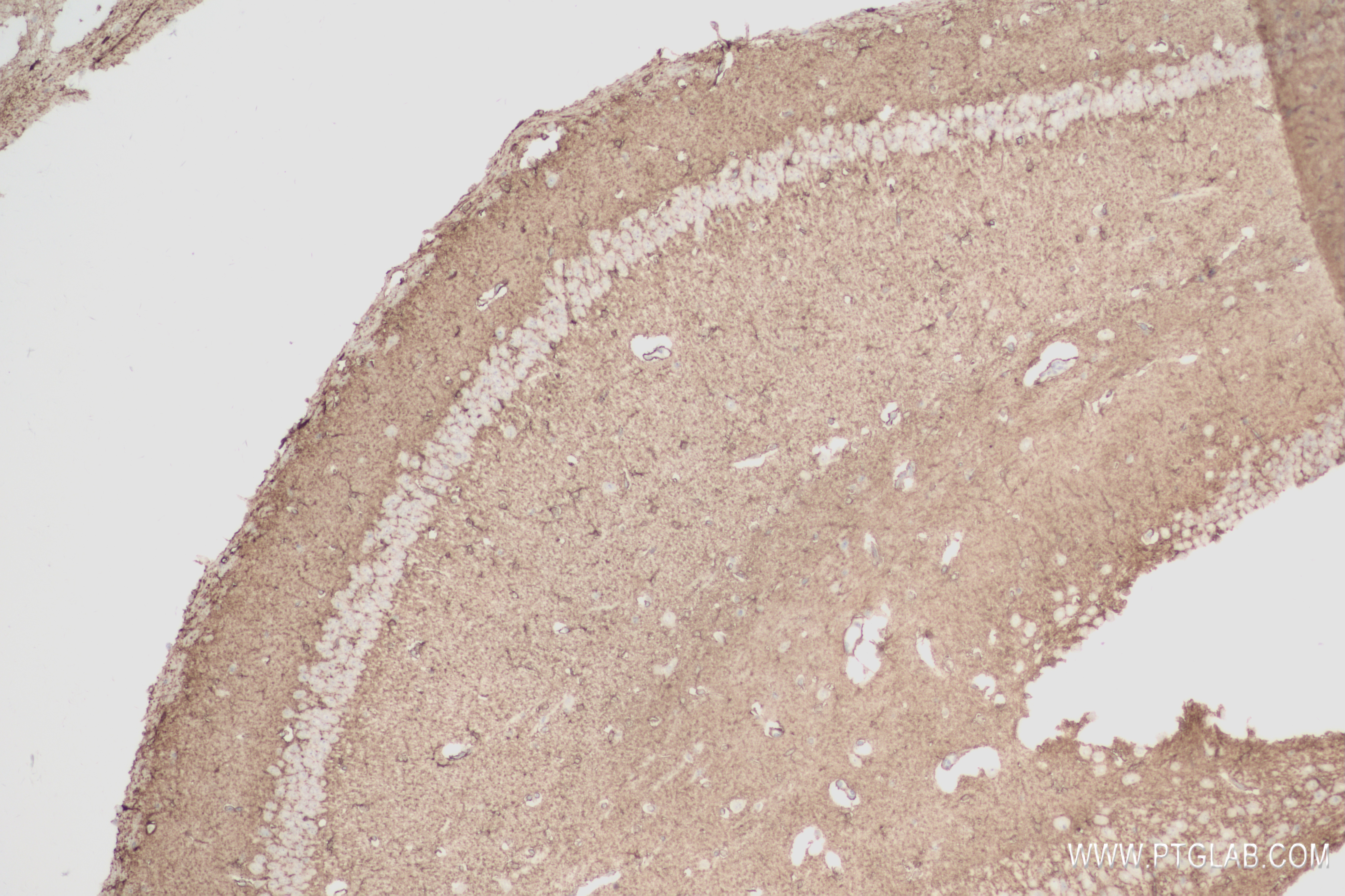 IHC staining of mouse brain using 83902-7-RR (same clone as 83902-7-PBS)