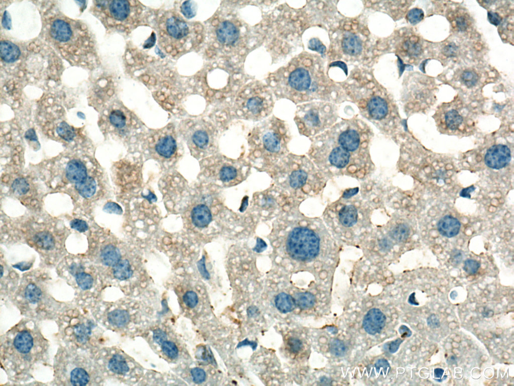 IHC staining of mouse liver using 15561-1-AP