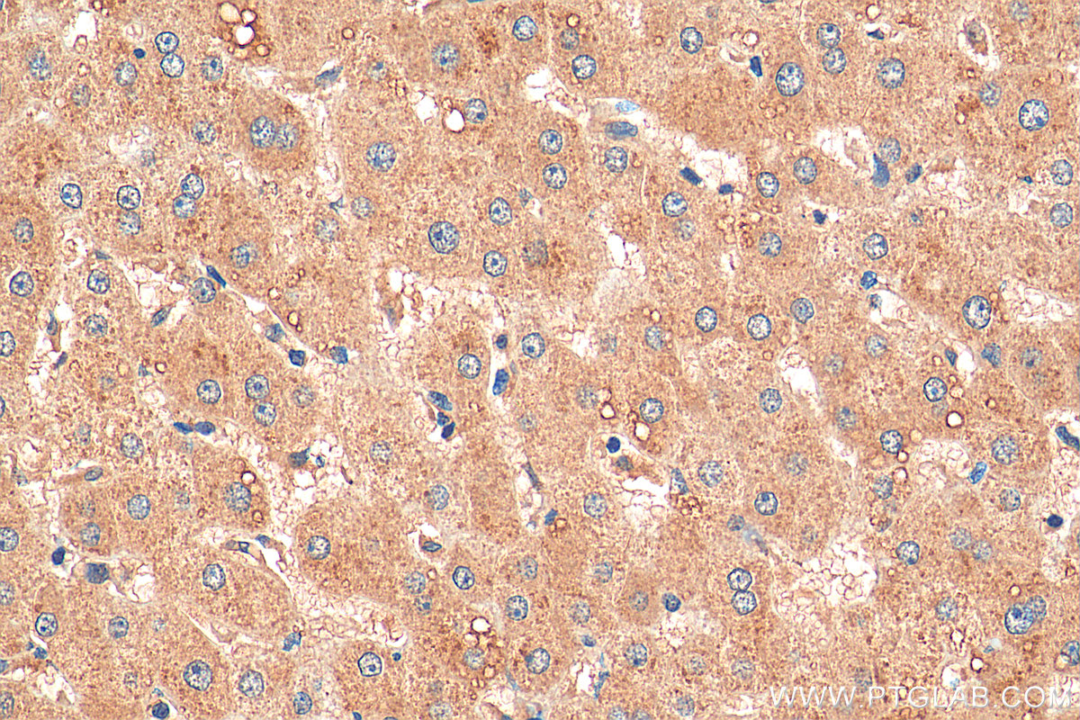 IHC staining of human liver using 17257-1-AP