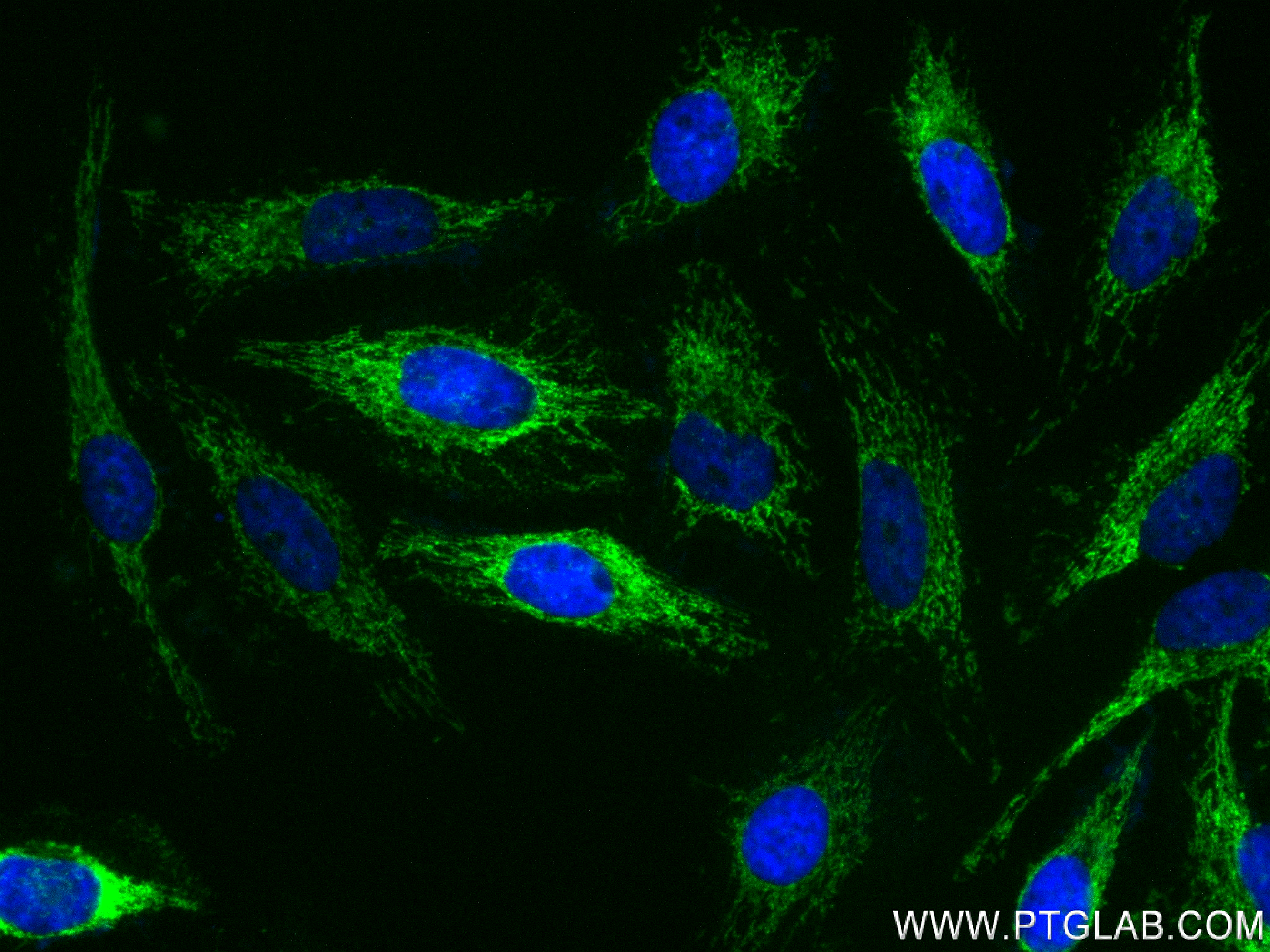 IF Staining of HeLa using 84498-1-RR (same clone as 84498-1-PBS)