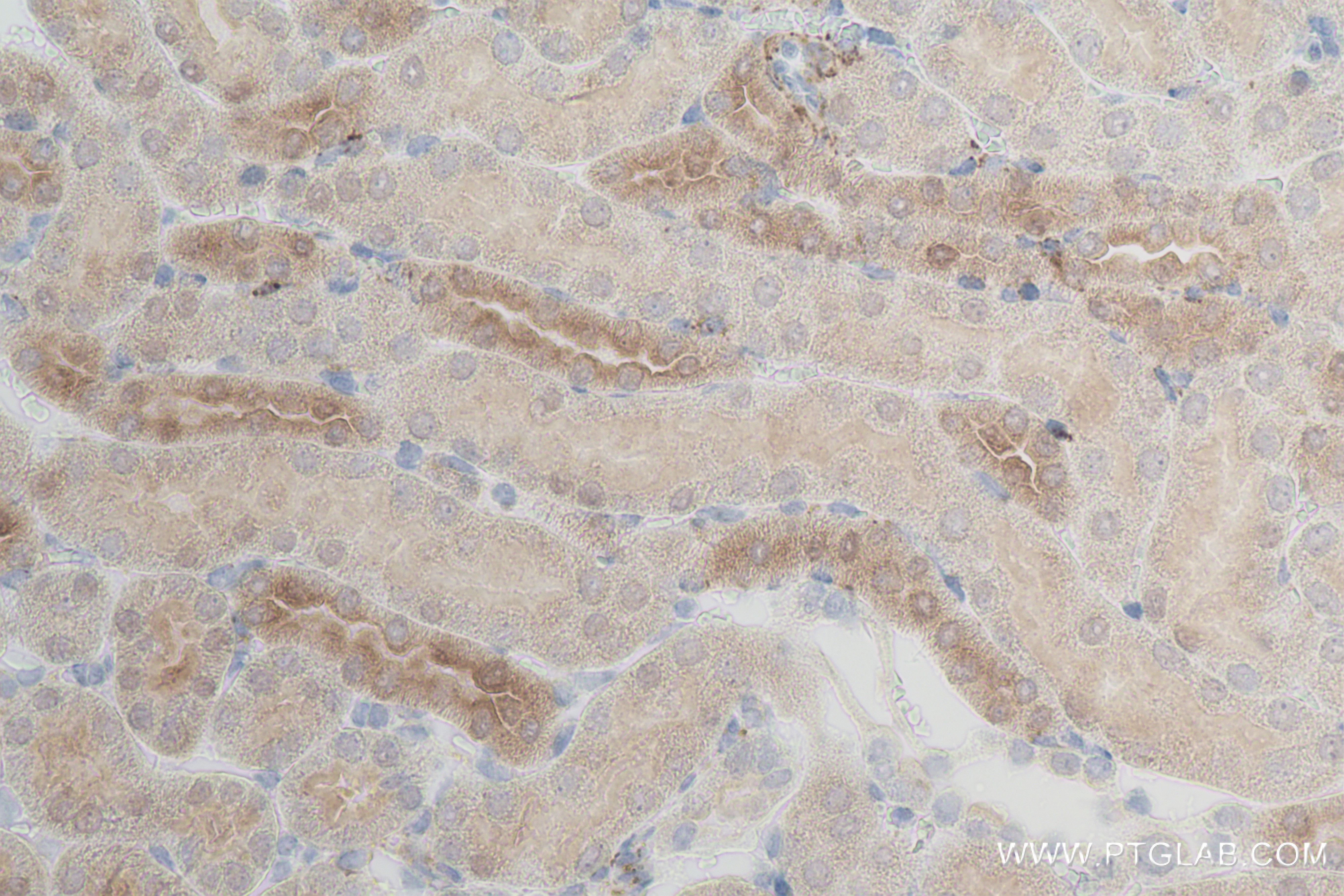 IHC staining of mouse kidney using 84498-1-RR (same clone as 84498-1-PBS)