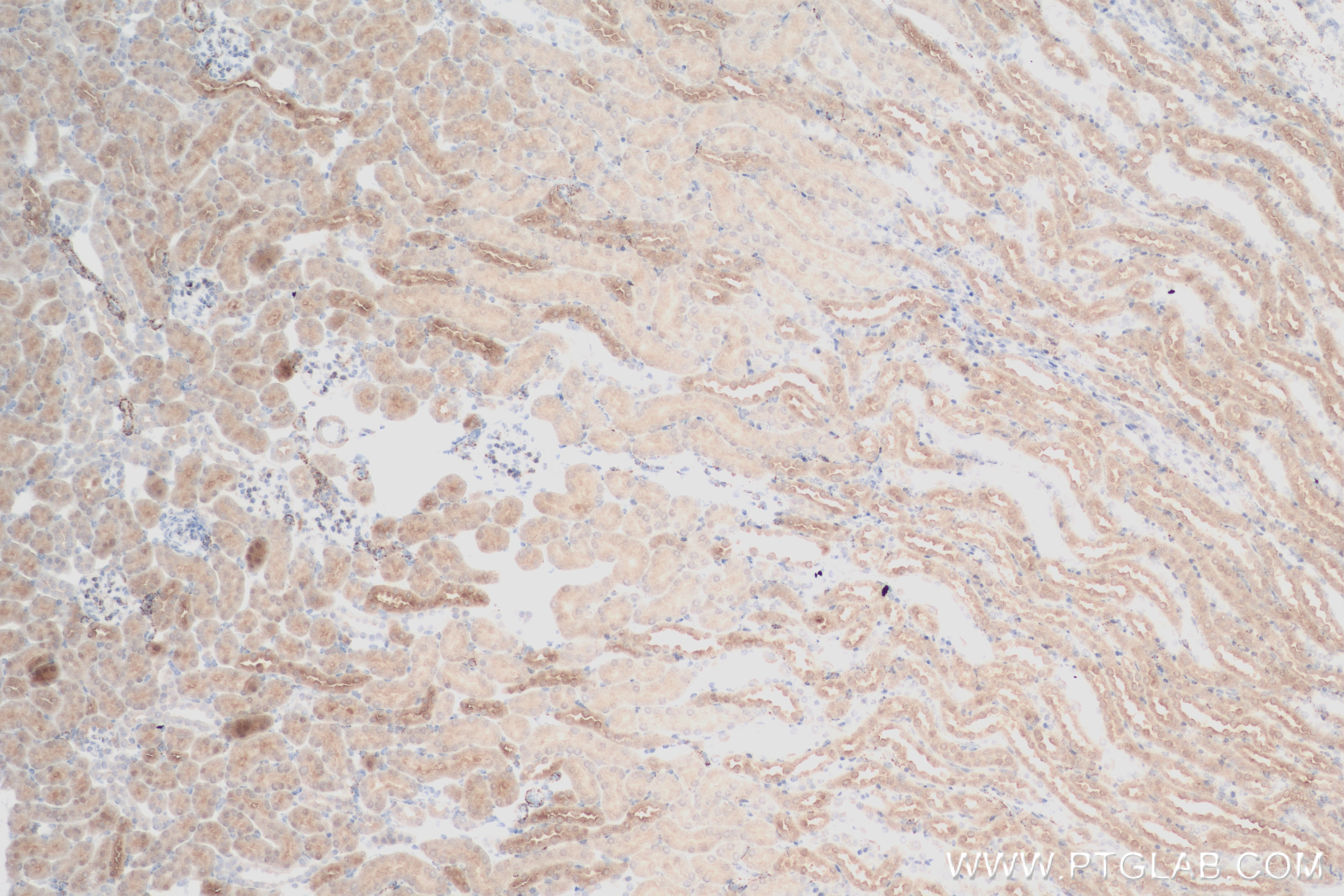 IHC staining of mouse kidney using 84498-1-RR (same clone as 84498-1-PBS)