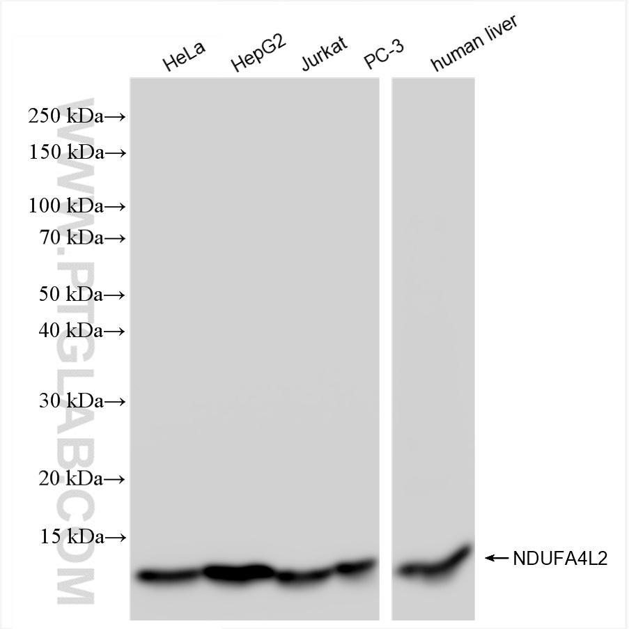 WB analysis using 84498-1-RR (same clone as 84498-1-PBS)