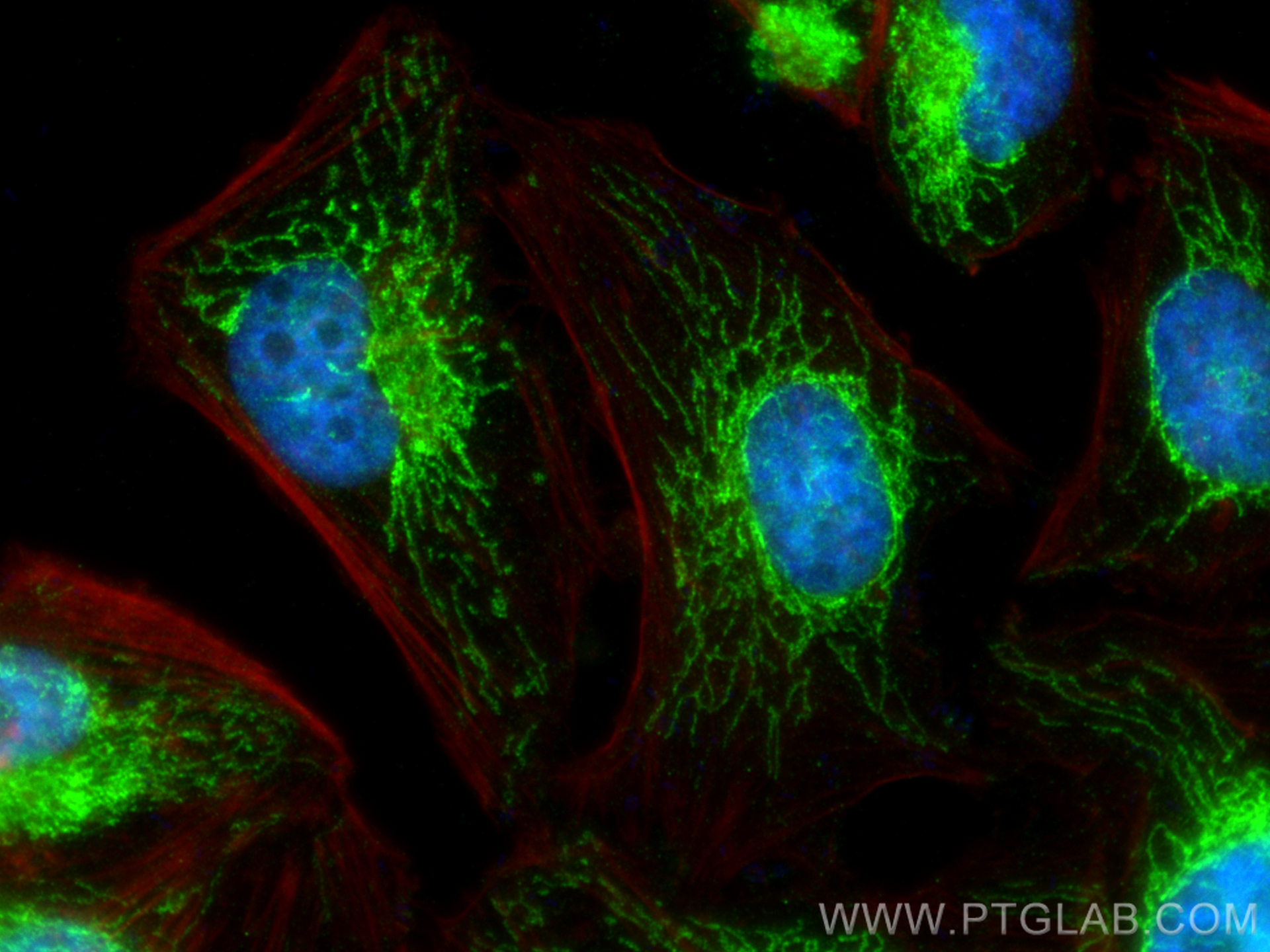 IF Staining of HeLa using 27931-1-AP