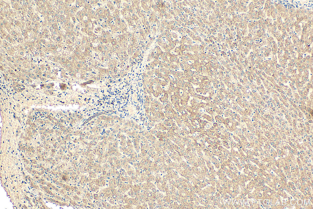 IHC staining of human liver using 67690-1-Ig (same clone as 67690-1-PBS)